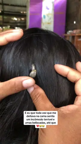 😭💔💔 #cabelo #mulher #beleza #hospital #carrapato #mulheres #relatos 