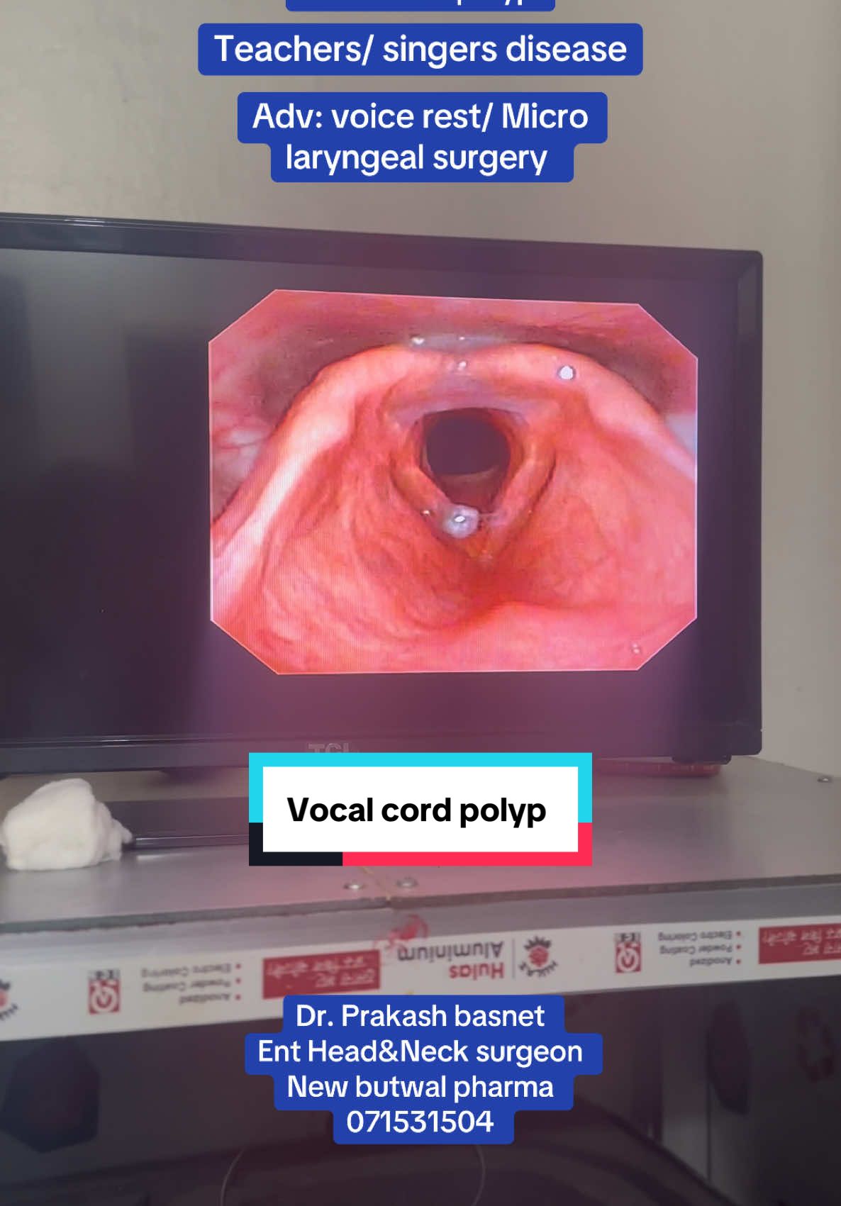 #vocalcordpolyps #foryou #viral #trending #fyp #entdoctorbutwal #ent #fypシ゚viral #tiktoknepal 