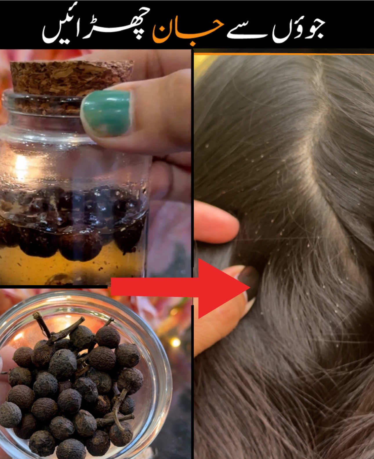 Head live removal oil #lice #headlice #liceremoval #haircare #hairgolas #shumailasdiary 