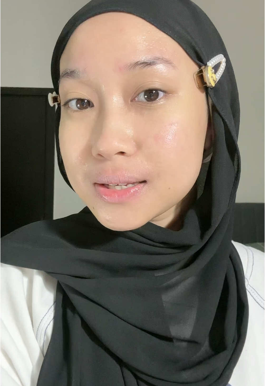 hal penting waktu kulit lg breakout selain merhatiin skincare juga harus merhatiin air cuci muka yg dipakai harus higenis & ph nya sesuaii🥰✨ #tipskulitsehat #skincaretips #skincarehacks 