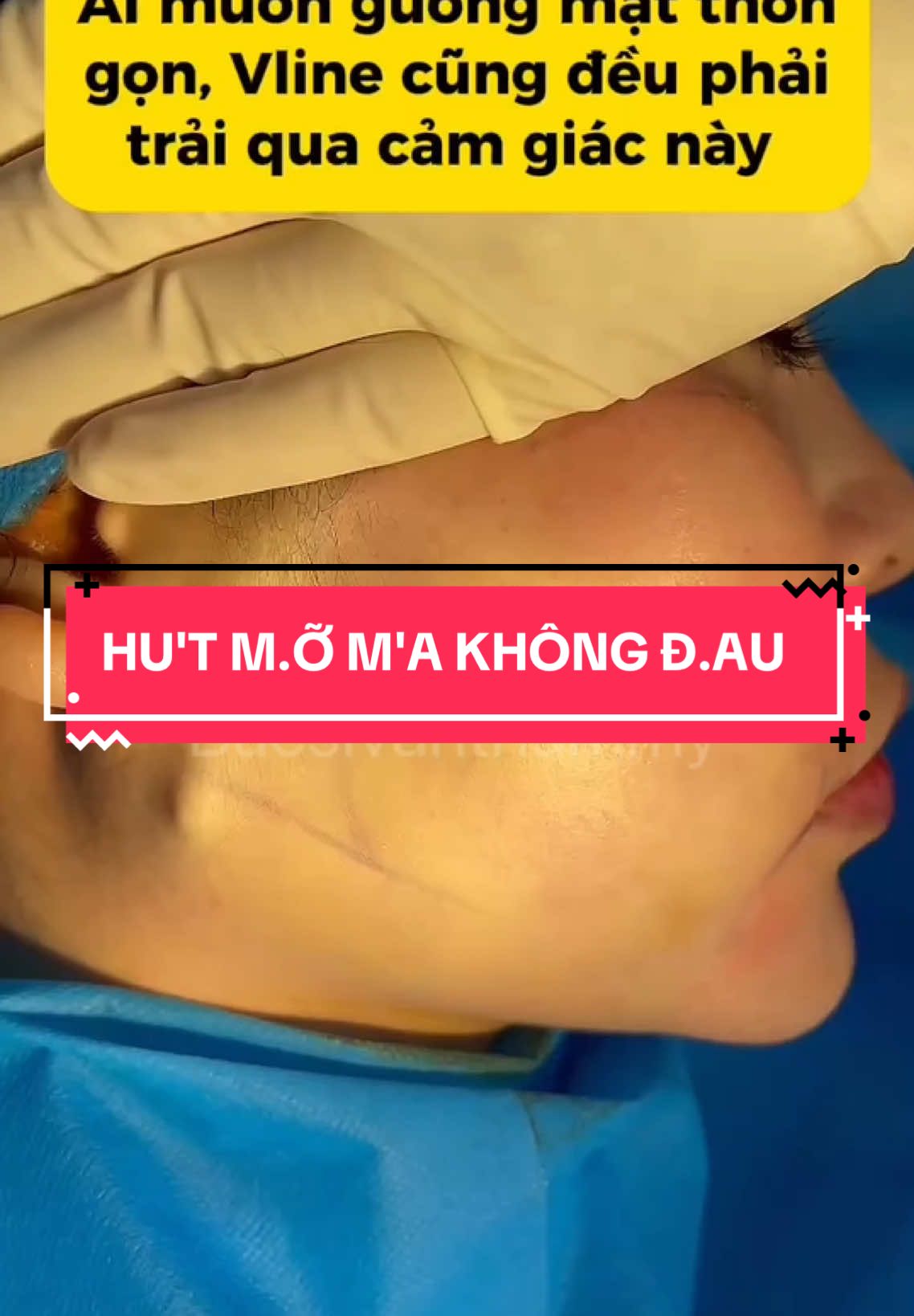 Thực ra là cũng không có cảm giác gì 😝 #bacsivanthammy #hutmo #hutmoma #hutma #laytuimoma #hutmomangoai #hutmonongcam #hutmonong #hutnong #hutmat #thongonmat #hutmotoanthan 