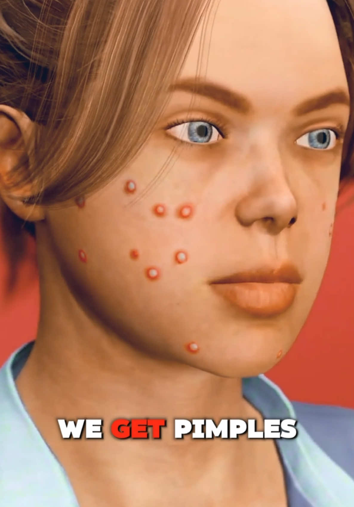 Why Do We Get Pimples? (3D Animation) #pimple #pimplepopping #pimplepopper #pimplesolution #pimplesremoval #pimplesremove #pimplesremover #pimplespimples #pimples_brufoli_ #pimplessuck #pimplespottreatment #pimplespop 