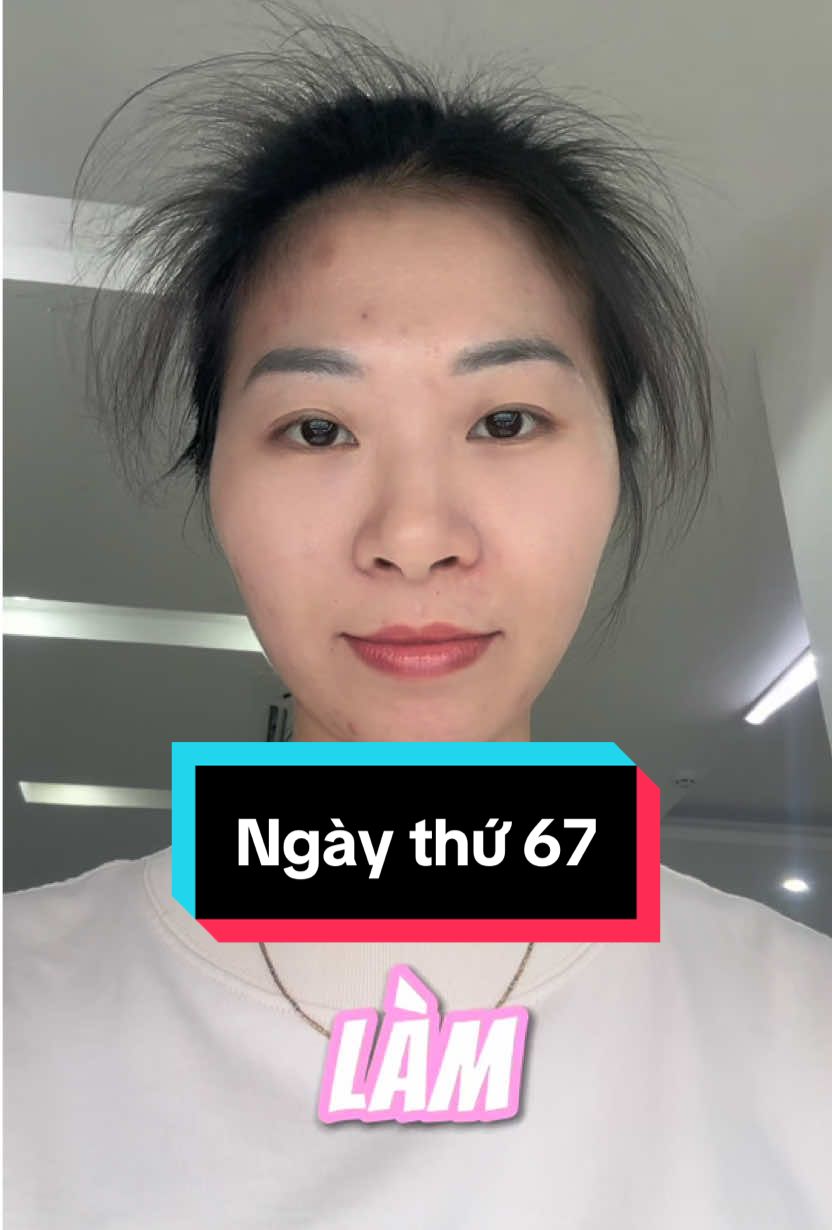 P67| Làm thế nào tóc mọc ngang ngửa, lởm chởm như thế này? Kết quả 2 tháng chăm sóc tóc đó ạ #moctoc #kichthichmoctoc #duongtoc #chamtoctainha #gung #thebodyshop #daugoi #utoc #xitmoctoc #trend #viral #xuhuong 
