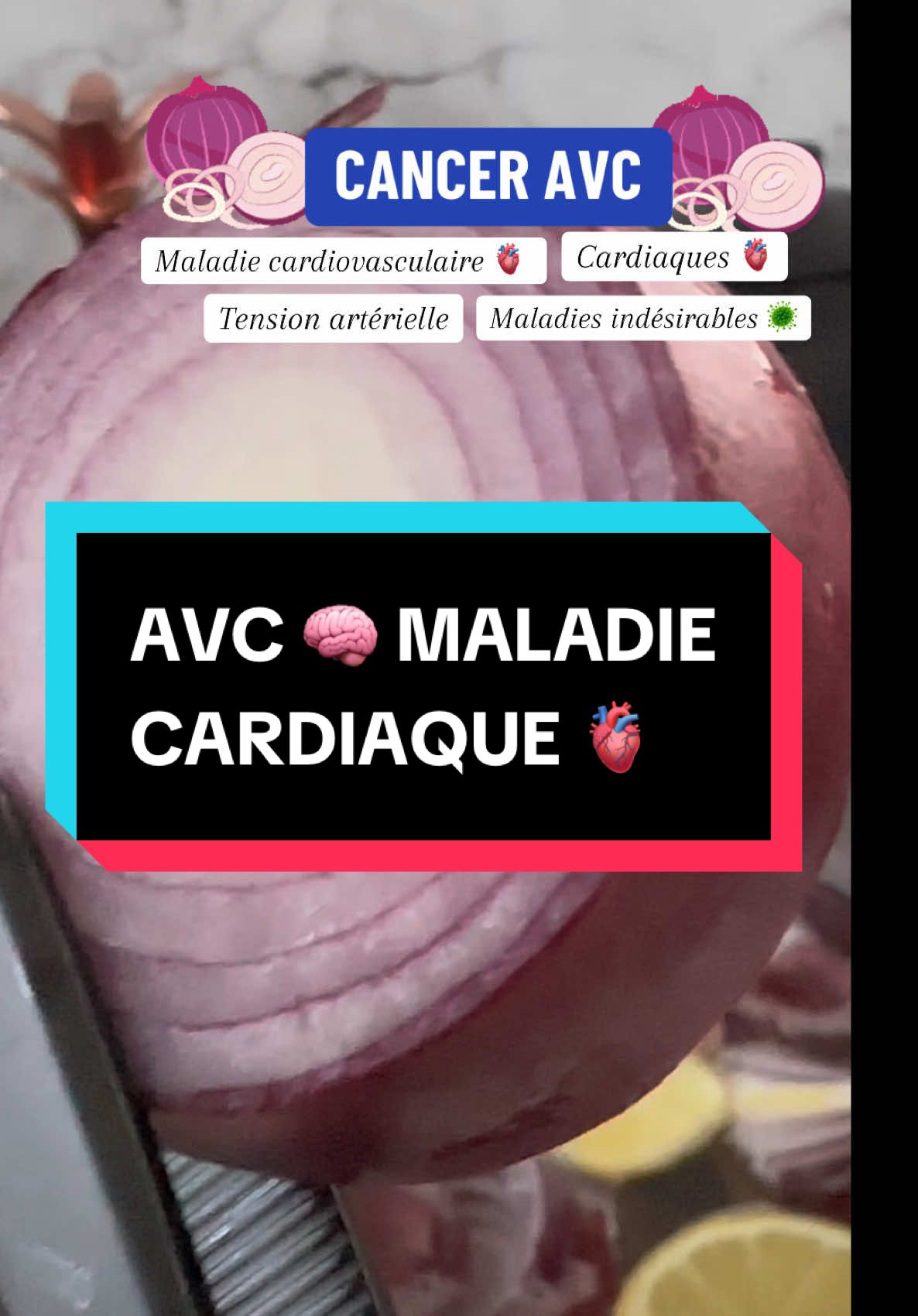 Les problèmes des malaises sont lié a la mauvaise alimentation #sante #avc #diabet #cancer #avc #tension #oignon #maladie #cerveau #coeur #tension #onion #drakafelix s #vie #sante #heart 