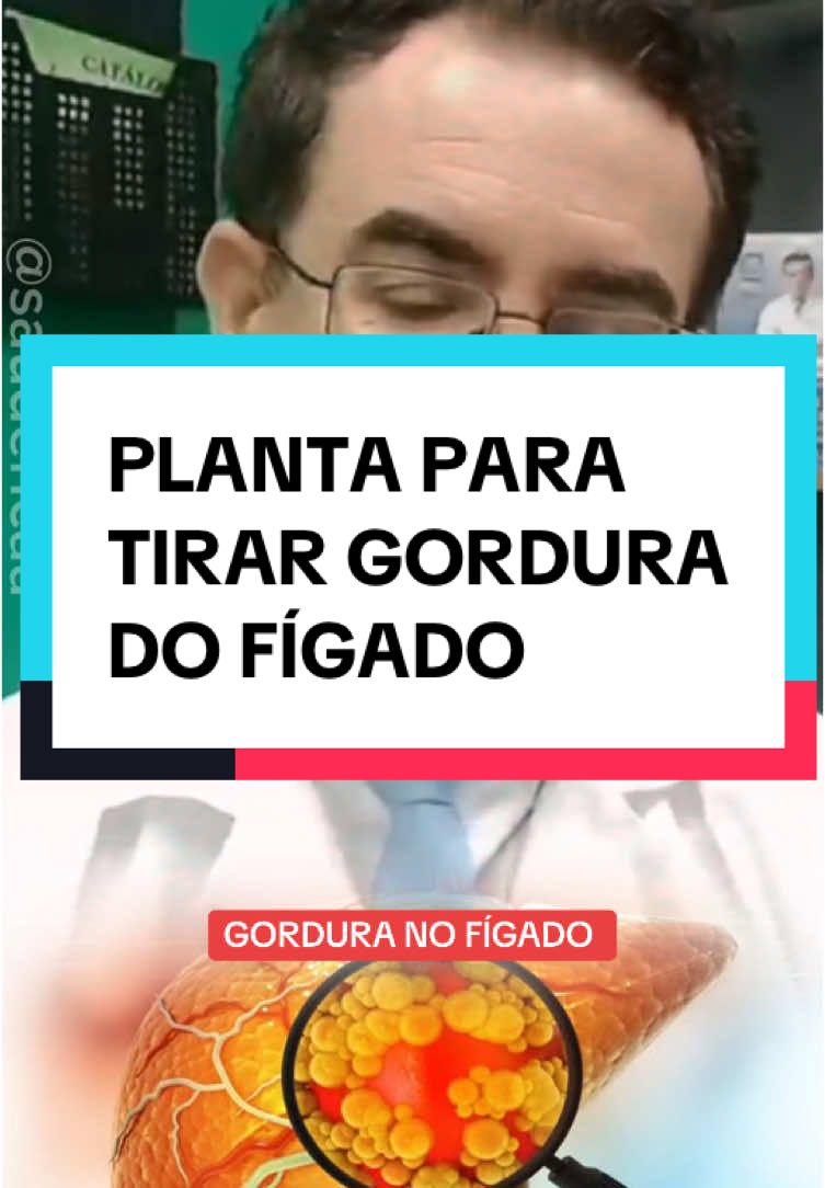 Dr. Tiago Rocha fala sobre a planta Cardo-mariano que serve para ajudar na limpeza da gordura do fígado! #dicasdesaúde #dicasdesaude #saude #saúde #esteatosehepatica #gorduranofigado #figado 