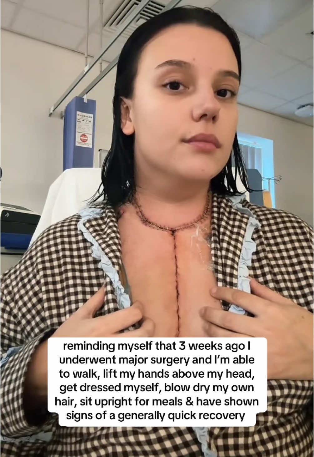 It’s easy to get bogged down and feel like no progress is being made, when so much of what you could do is so far out of reach, but I am able to do so much more than they expected me to be able to do at this stage. I can walk unaided (though i get very out of breath) I can shower myself stood up, wash and dry my own hair, get dressed myself, and even though i shouldn’t do some things such as tidying lightly, i am able to do it. Small small wins ❤️