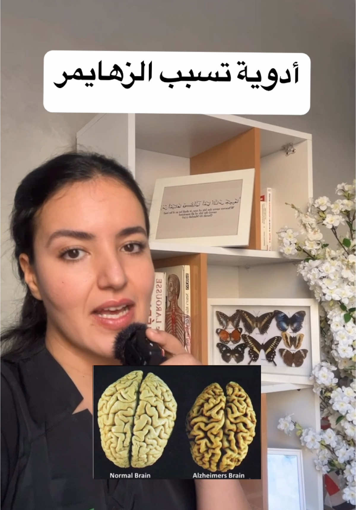 أدوية تسبب الزهايمر ⚠️⚠️