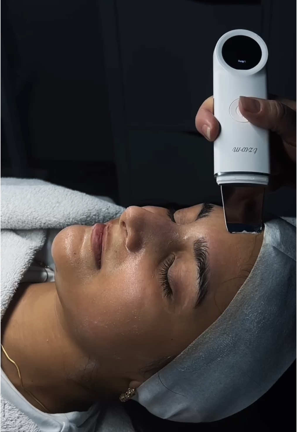 Microneedling-Treatment, jetzt ist die beste Zeit dafür. 1.Förderung der Kollagen und Elastinproduktion. 2.Reduktion von feinen Linien und Falten. 3. Verbesserung der Hautstruktur (Narben). 4.Behandlung von Pigmentstörungen. 5. Reduktion von Dehnungsstreifen. 6. Erhöhung der Wirkstoffaufnahem durch die Haut. Wann Buchst du dein Treatment! - #skin #skincare #skincareroutine #skincaretips #treatment #wiesbaden #akrricosmetics #needling #jellymask #viralreels #beauty #SelfCare #skincarereels #facial #spa #facialmassage 