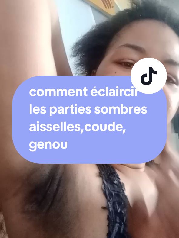 comment, éclaircir les parties sombres, foncée les aisselles,les coude, genou pied naturellement à la maison #routineskincare #astucebeauté #remedenaturel #viralvideos #fypシ゚viral #GlowUp 