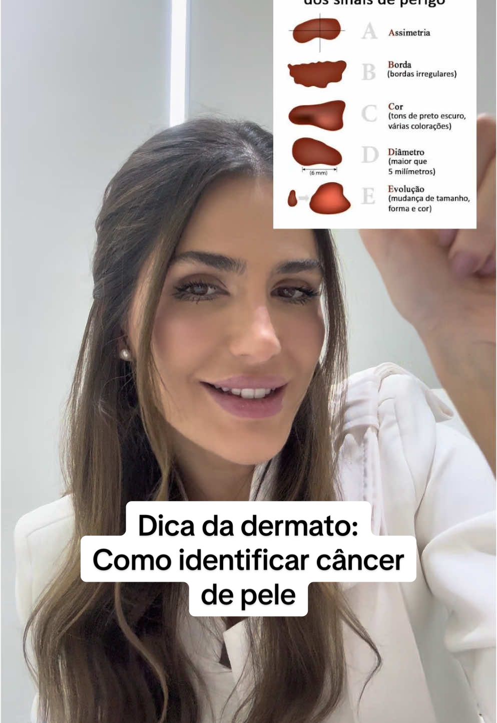 Como identificar o câncer mais comum no mundo #dermato #cancerdepele #dezembrolaranja 