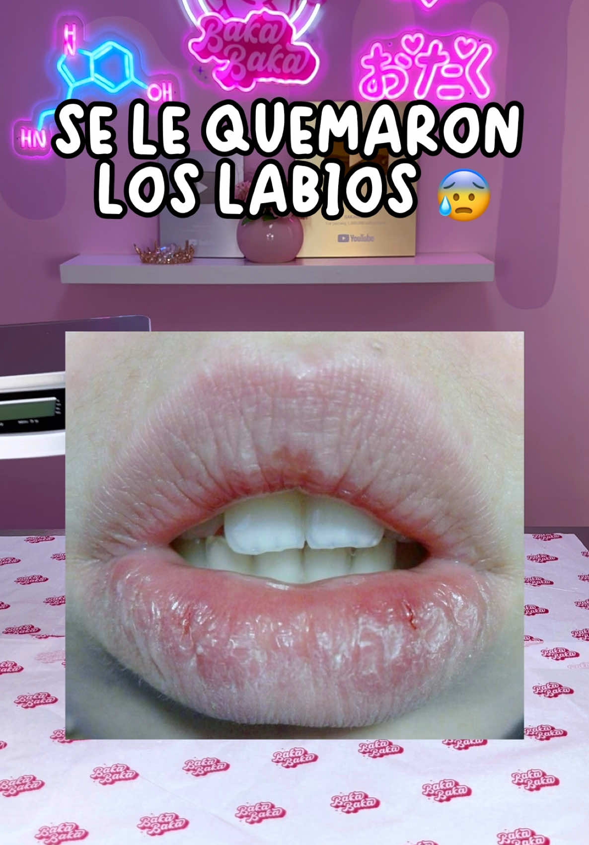 Respuesta a @_nayki_12 Y yo asi de 😳 #bakabakamx #lipgloss #makeup #fyp #minivlog 