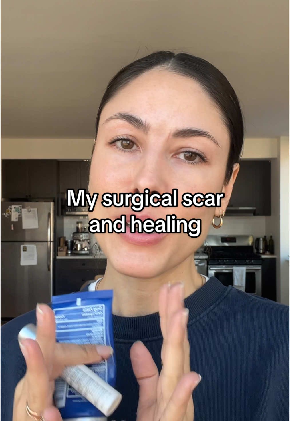 I’m the new scar girl 😩 Dermatofibroma removal post-op healing and fading my surgery scar @CeraVe #scartreatment #scar #facescar #facialscar #surgeryscars #scarhealing #scarcare #skintok #skinhealth #skinhealing #siliconescarsheets #siliconescargel #dermatofibroma #dermatofibromaremoval #cystremoval #greenscreen 