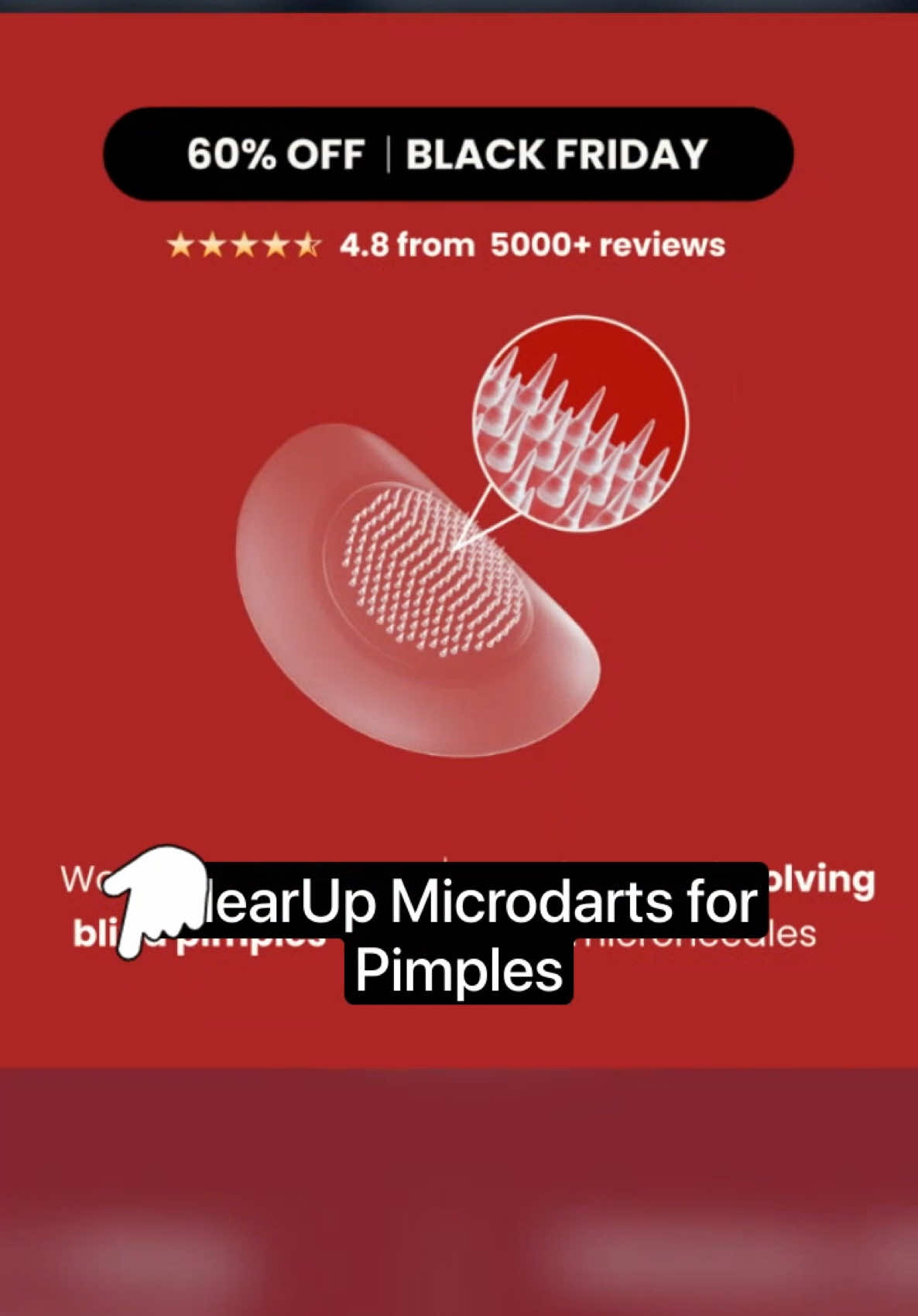 ClearUp Microdarts for Acne Microneedle Patches for Blind Pimples  Microdart Acne Patches Pure Hydrocolloid Skincare Skin Repair  #tiktoksg #tiktokshopsg #TikTokShop #createtowin #weeklywedrush #sgbrandweek #ClearUp #AcnePatches #MicroneedlePatches #SkinCare #AcneCare #HydrocolloidPatches #SkinRepair #ClearSkin #PimpleCare #AcneTreatment #SkinSolutions #BlindPimplePatch #AcneFree #BlemishControl #SkinHealing #SpotTreatment #SkincareEssentials #Hydrocolloid #BeautyCare #SkinFix #PimplePatch #GentleOnSkin #SkincareRoutine #ClearComplexion #SkinHealth #AcneSolutions #AcnePatch #Microdarts #PimplePatchCare #BlemishPatch #SkinCareDaily #AcneFighter #SpotCare #ClearComplexionGoals #SmoothSkin #SkinCareProducts #AcneRelief #PimpleSolution #MicroneedleTechnology #SkinRecovery #FlawlessSkin #BreakoutSolutions #GentleCare #AcneHealing #QuickSkinFix #SkinCareMustHave #NoMorePimples #HydrocolloidHealing #DailySkinCare #PimplePrevention #SkinCareForAll 