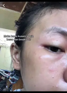 Aaaaaa hasilnya mantul banget kannn??? 😭😭🫵🏻 #serumsaffron #serumviral #skincare #serumsaffronvies #moisturizer #fyp #berandatiktok 