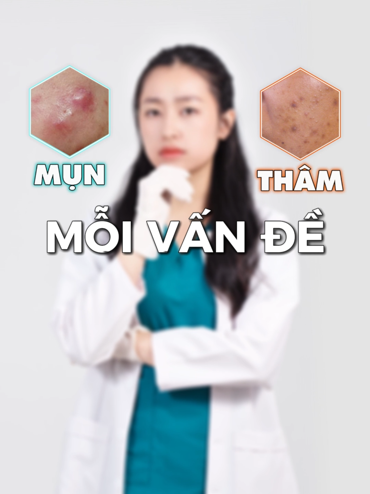 Giải pháp chuyên biệt cho thâm và mụn #azderma #reviewlamdep #skincare #gelmunzincerra #gelgiamthamazera