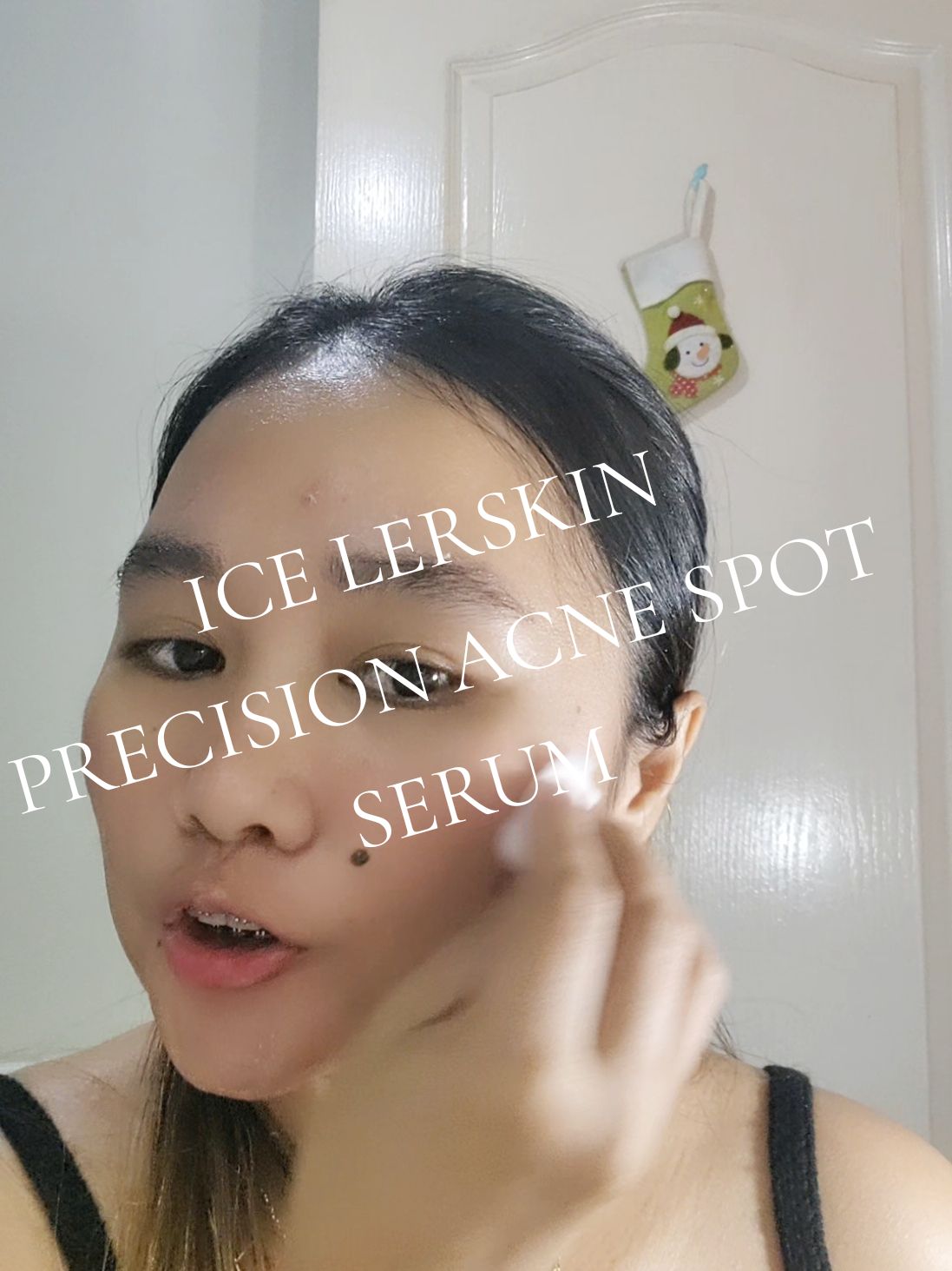 Replying to @bhebielove25 ICE LERSKIN ACNE SERUM, IF MAY TANONG PO ABOUT SA ATING SKINCARE MAG COMMENT LANG PO🤗 #acnetreatment #icelerskin #icelerskinph #skincaretips 