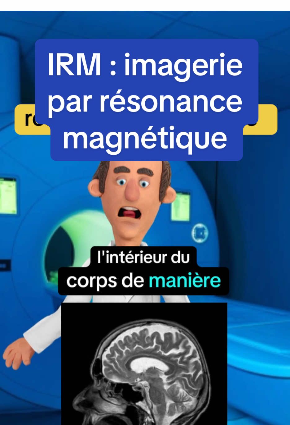 L’IRM décrypté #irm #imagerie #examen #medecine #vulgarisation #etudianteinfirmière #etudiantmedecine  