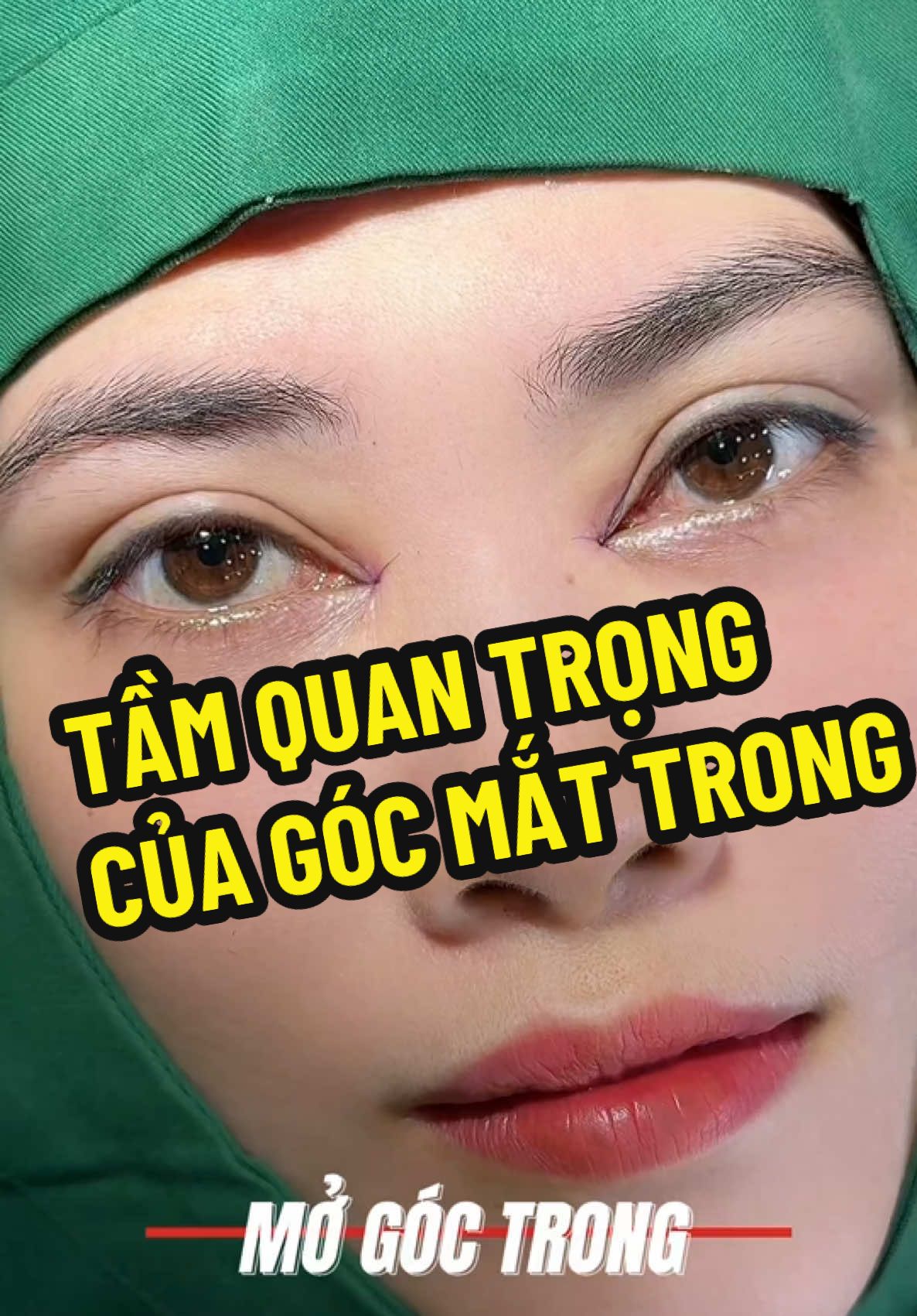 Chưa mở góc trong … Chưa biết mắt đẹp cỡ nào?! 😄😄#THAMMYTHUYLE #phauthuatthammytunhien 