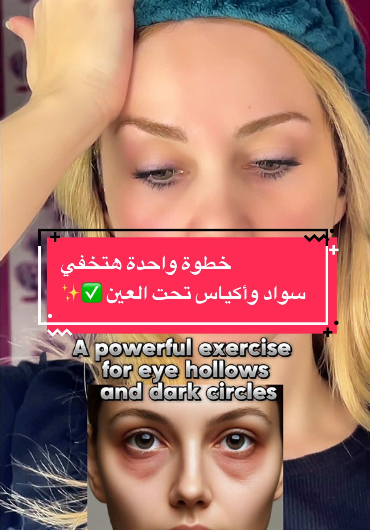 خطوة بسيطة هتخفي سواد واكياس تحت العين✨✅#faceyoga #facemassage #yogaflow #yogalover #مساج #مساج_علاجي #massagetherapy #تدليك_الوجه #محمود_الجبلي #tik_tok #viral_video #facemask #tiktoktips #massagem #tiktoklongs #مساج_الوجه 