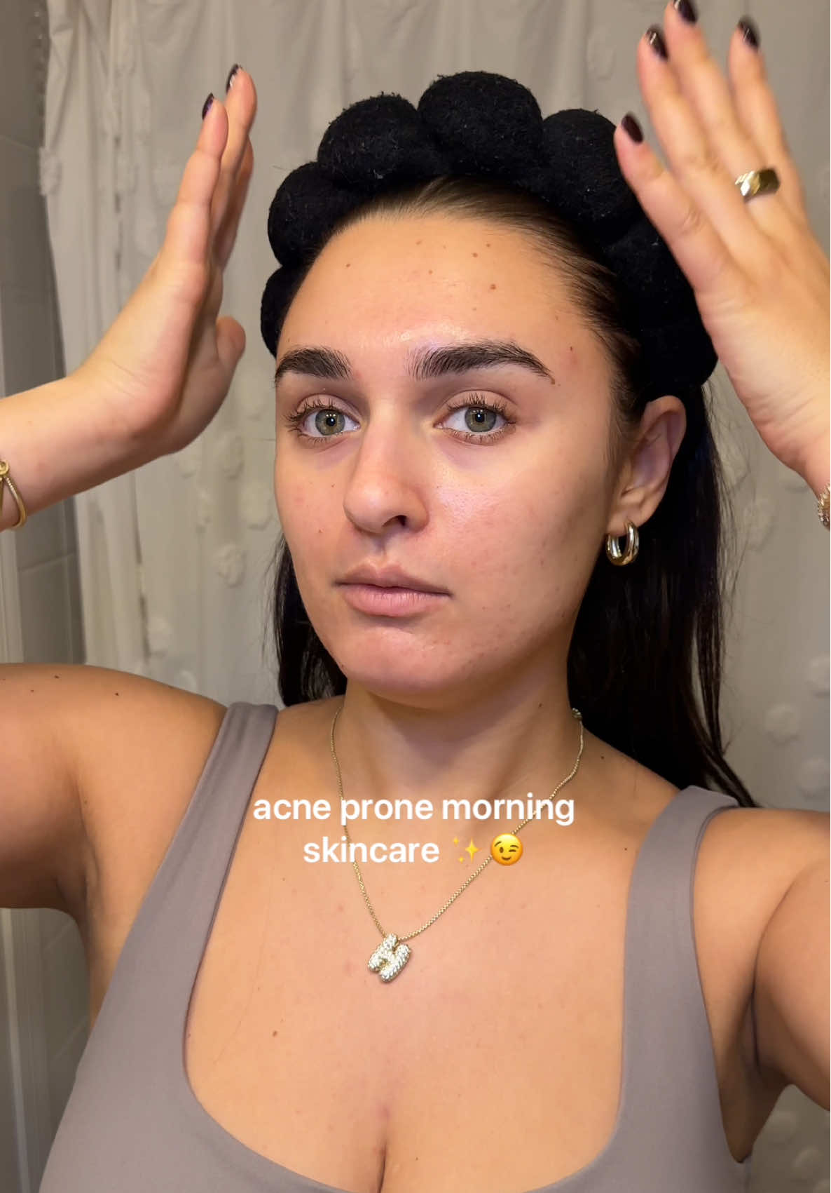 If were getting banned in a month… it’s time to have a little more fun on this app😉 #acneawareness #acneproneskin #acneskin #acneskincare #acnetreatment #acnejourney #hormonalacne #cysticacne #acnefighter 