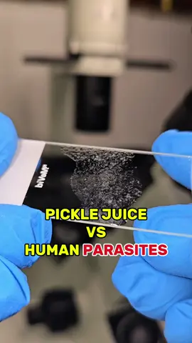 #Fyp#viral_video #picklejuice #parasites #microscope #interesting 