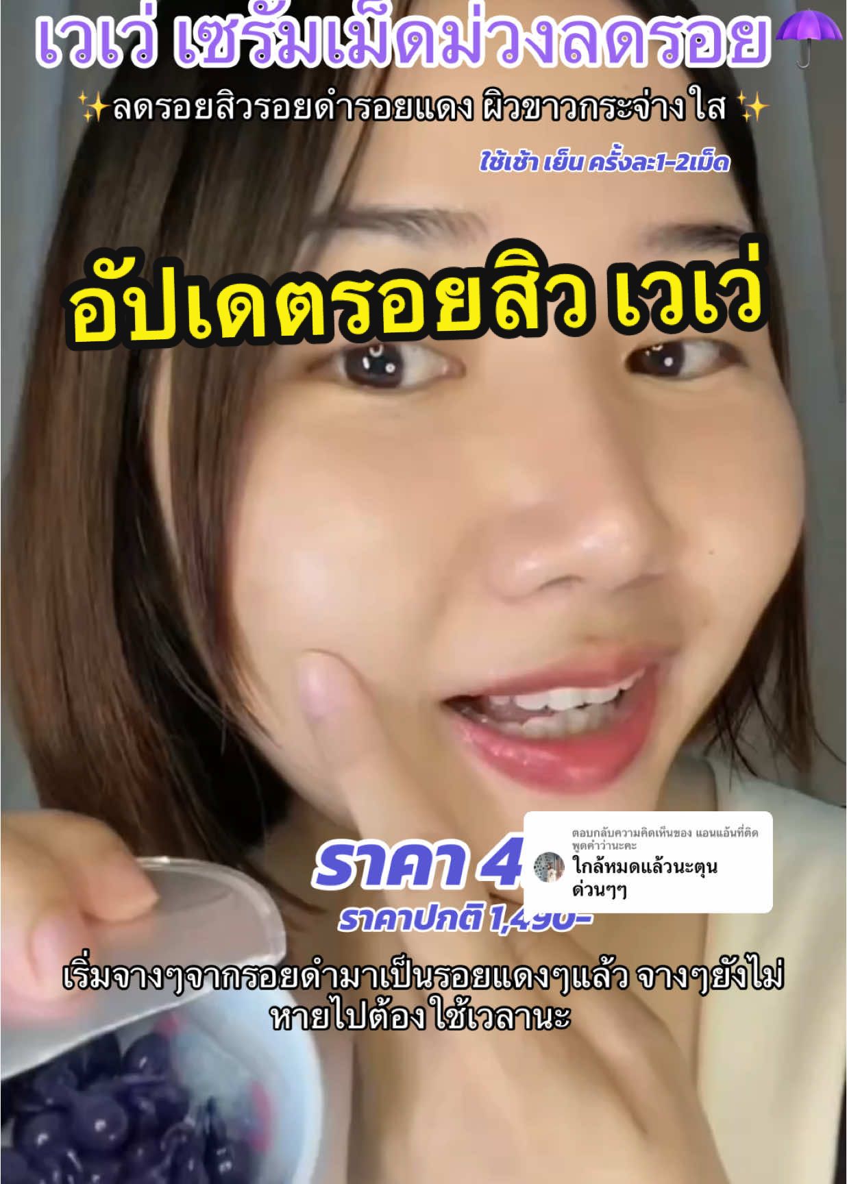 ตอบกลับ @แอนแอ้นที่ติดพูดคำว่านะคะ ผลลัพธ์ที่ได้ขึ้นอยู่แต่ละบุคคล#เวเว่ลดรอย #เม็ดม่วงลดรอยดํา #ลดรอยดํารอยแดงจากสิว #veve #รีวิวบิวตี้ #ของดีบอกต่อ #ฟีดดดシ #รีวิวจากผู้ใช้จริง 