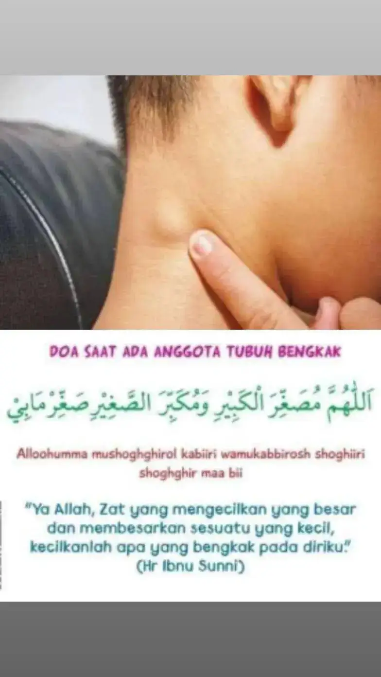 Petua terbaik hilangkan segala bengkak pada anggota badan termasuk bengkak kelenjar, ketumbuhan, bengkak gusi, kaki, mata dan sebagainya. Cara-caranya:  Sebelum memulakan bacaan: 1. Istighfar 3x. 2. Shalawat Nabi 10x. 3. Al-Fatihah 1x. 4. Ayatul Kursi 1x Kemudian diikuti dengan doa surut bengkak. Semasa baca doa ini pejam mata dan bayangkan Allah mengecutkan bengkak, mematikan akar dan menyembuhkan segala luka.  Setap usaha yang kita lakukan sandarkan pada Allah.  Semoga Bermanfaat...Aamiin #fypシ゚viral 