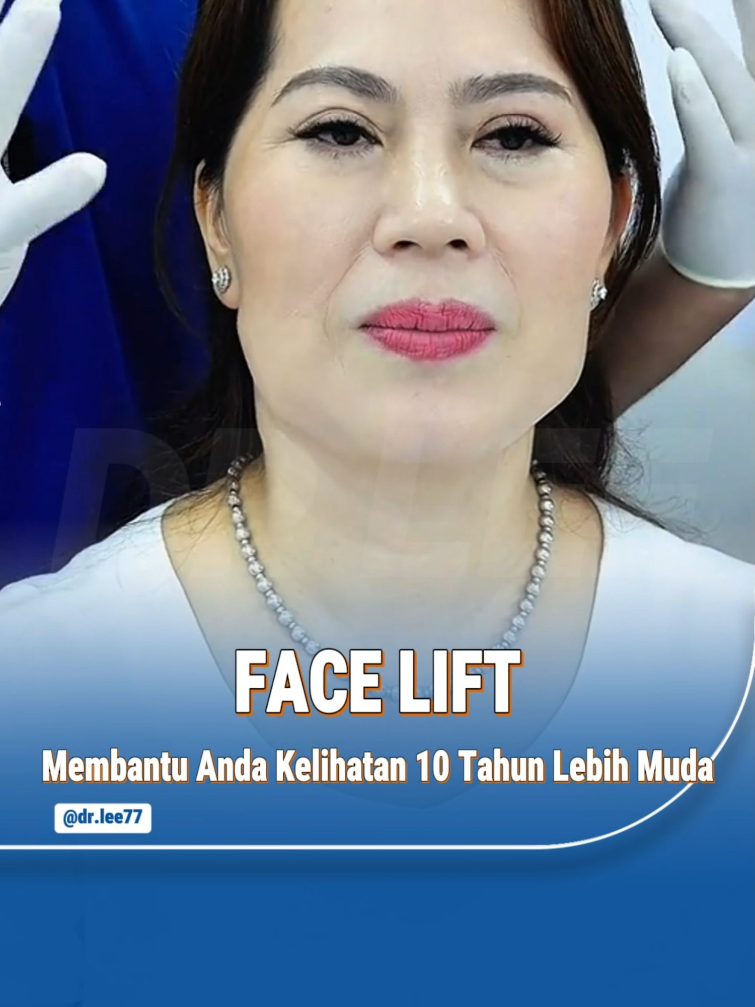 Face Lift diskaun 50% #malaysiatiktok #johorbahru #kualalumpur #Facelift #fullface #fyp #Facelifting