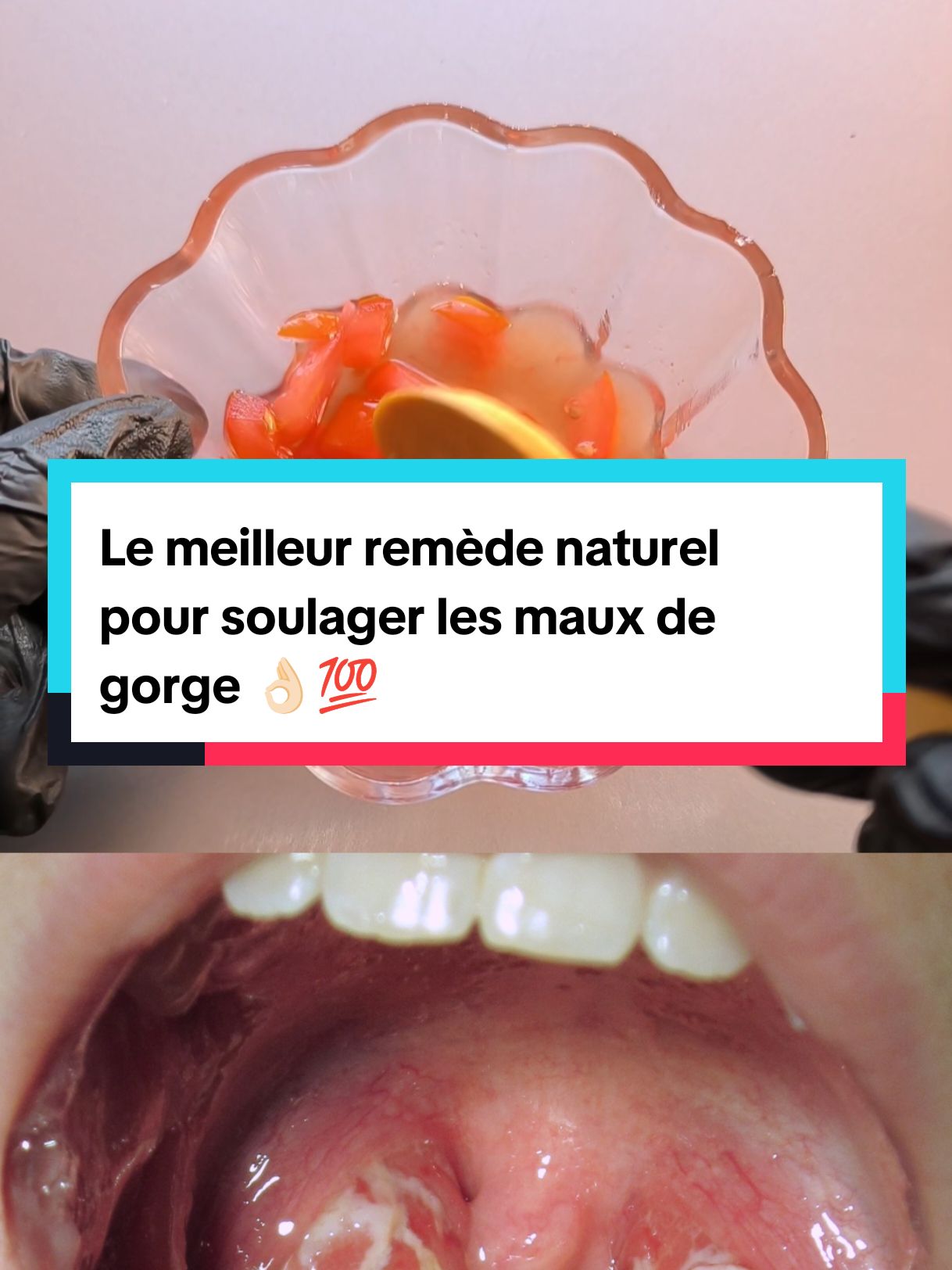 Le meilleur remède naturel pour soulager les maux de gorge  #mauxdegorge #angine #remedenaturel #recettefacile #soisnaturel #france🇫🇷 #LIVEFest2024 @SoisNaturel @SoisNaturel @SoisNaturel 