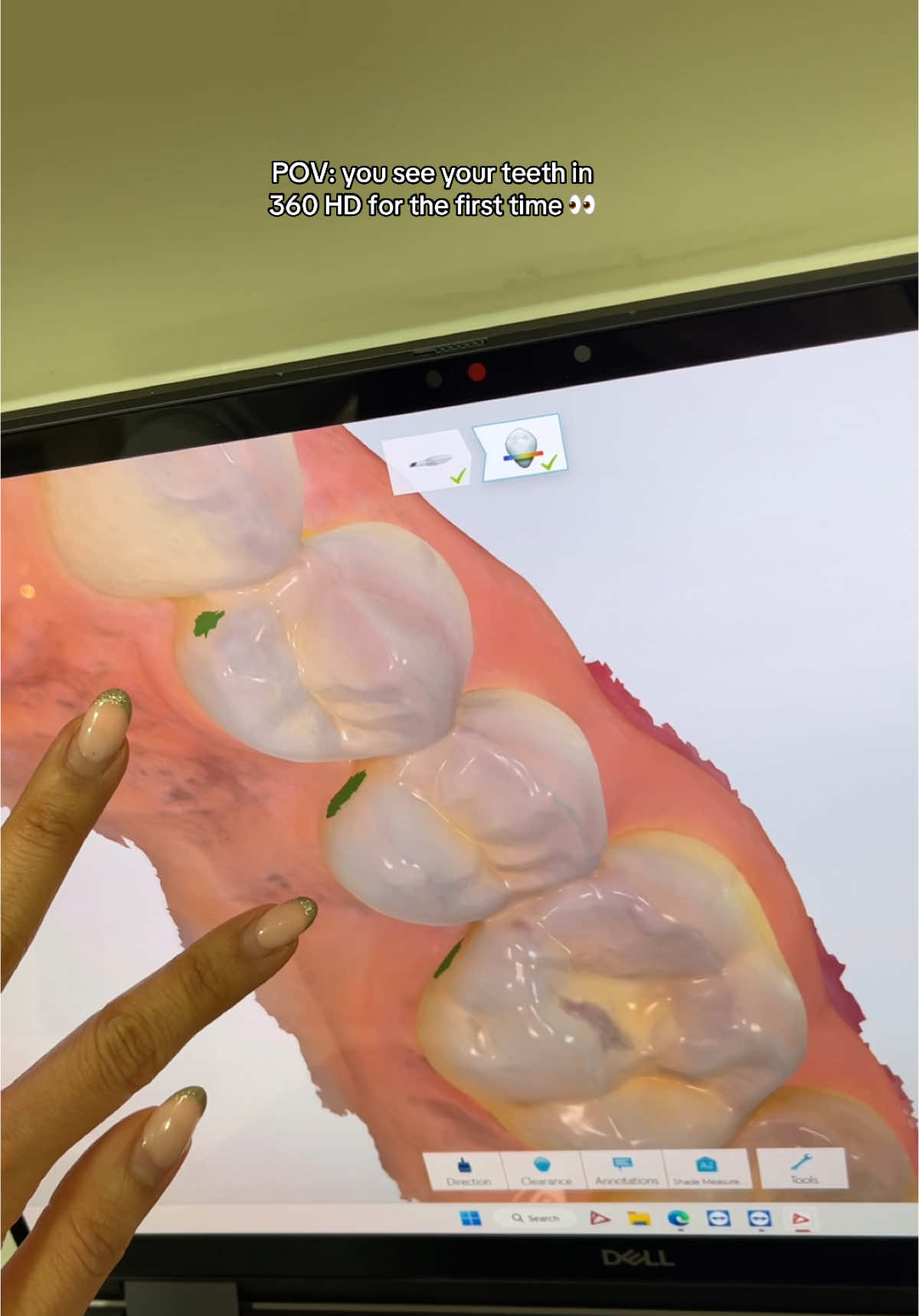 We include a 3D digital scan free with all of iur dentql checkups 😊#dentist #dentistry #londondentist #fyp #goviral #smilemakeover #invisalign #digitalscanner #ukdentist #londonmarylebone  