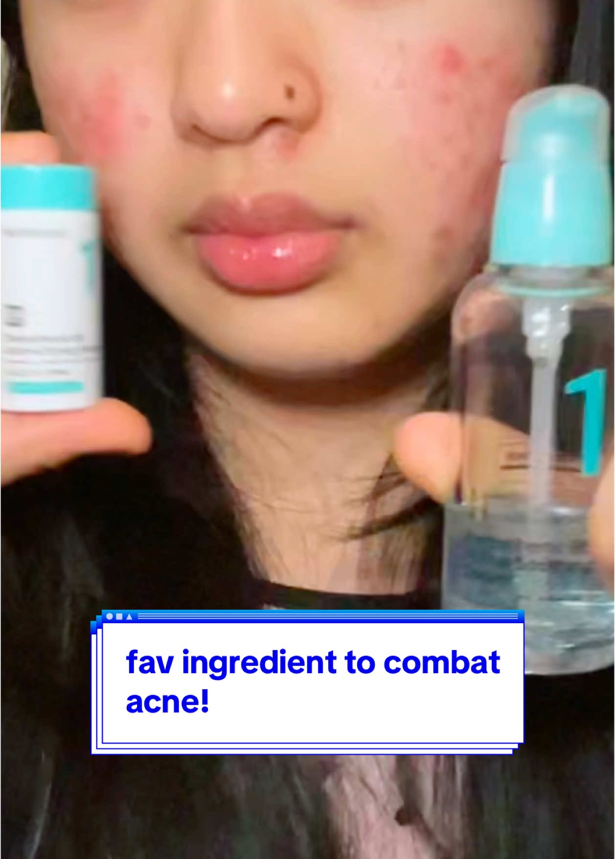 im abt to buy another serum its so good  #viral #trending #fyp #shadowbanned #koreanbeauty #kbeauty #beauty #kskincare #koreanskincare #skincare #acne #acneproneskin #pantothenicacid #pantothenicacidserum#whiteheads #acneprevention #acnebreakout #sensitiveskin #sebum #koreanserum #koreanskincare #kbeauty #skincare #serum #numbuzin #Inverted 