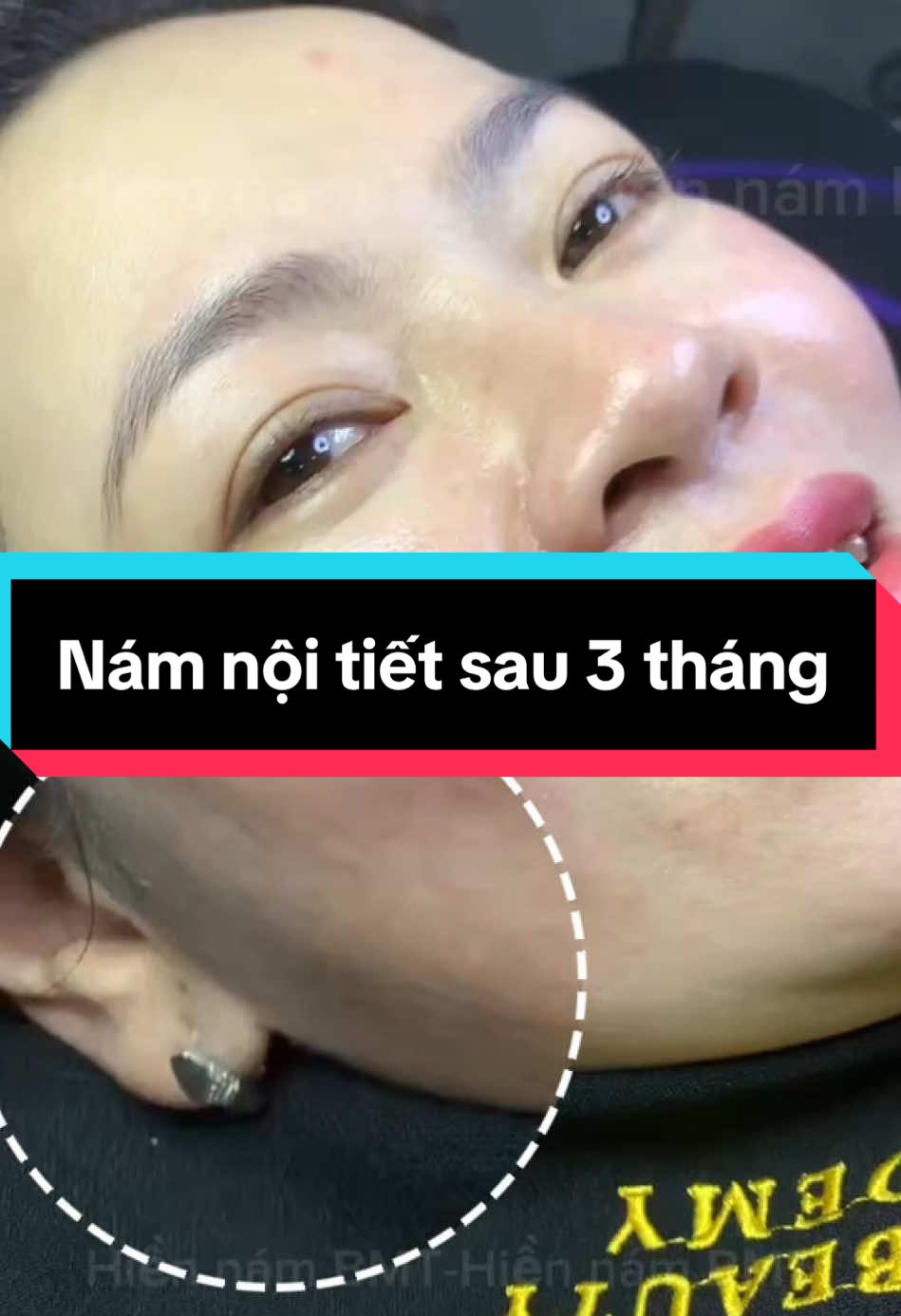 3 tháng nuôi da ức chế với kết quả này xứng không??#hiennambmt #namnoitiet #trinambmt #LIVEhighlights #xh 