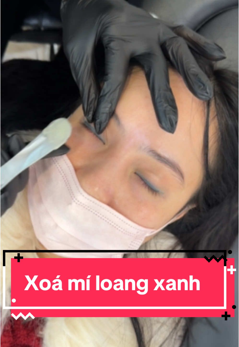 Chị gái bay✈️ từ Nhật về qua em Hoa xoá mí. Theo dõi em từ 1-2 năm trc ruii. #xoaxam #xoaxamluuhoa #xuhuong #laserpico #trendingvideo #xoalongmay #xoami #nhachaymoingay #xoamimat 