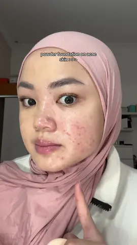 Kl males makeup ribet tp banyak bekas jerawat, pake powder foundation. Ini lg pake yg baru keluar, punya G2G!! High coverage bgttt #makeup 