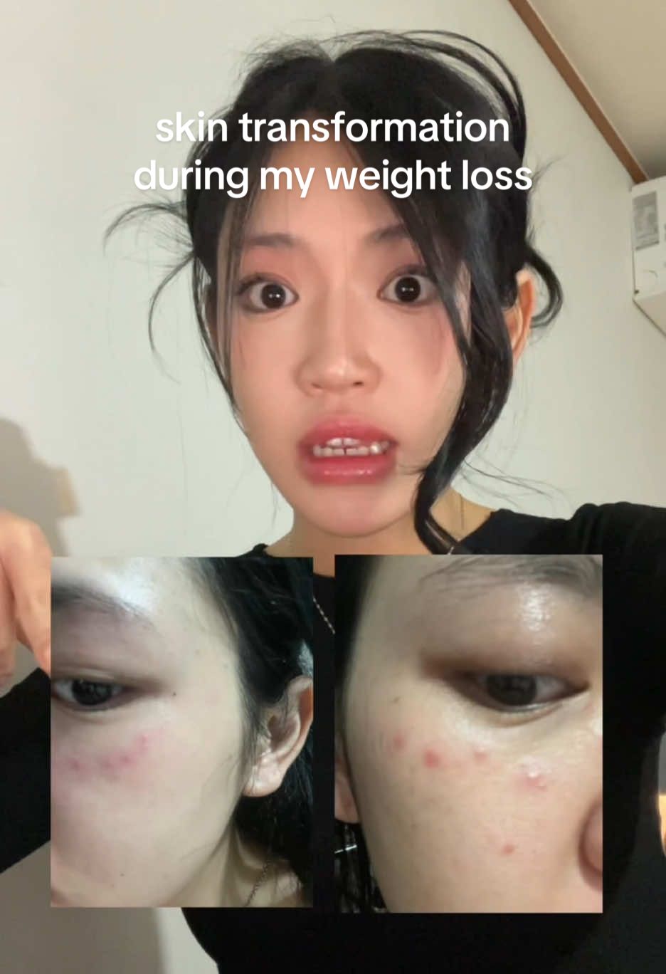 Replying to @thuy duong tran140 hehehe hopes this helps! be sure to have a healthy diet💗  #weightloss #gym #beforeandafter #skincare #skincareroutine #skincaretips #glassskin #koreanskincare #dralthea 