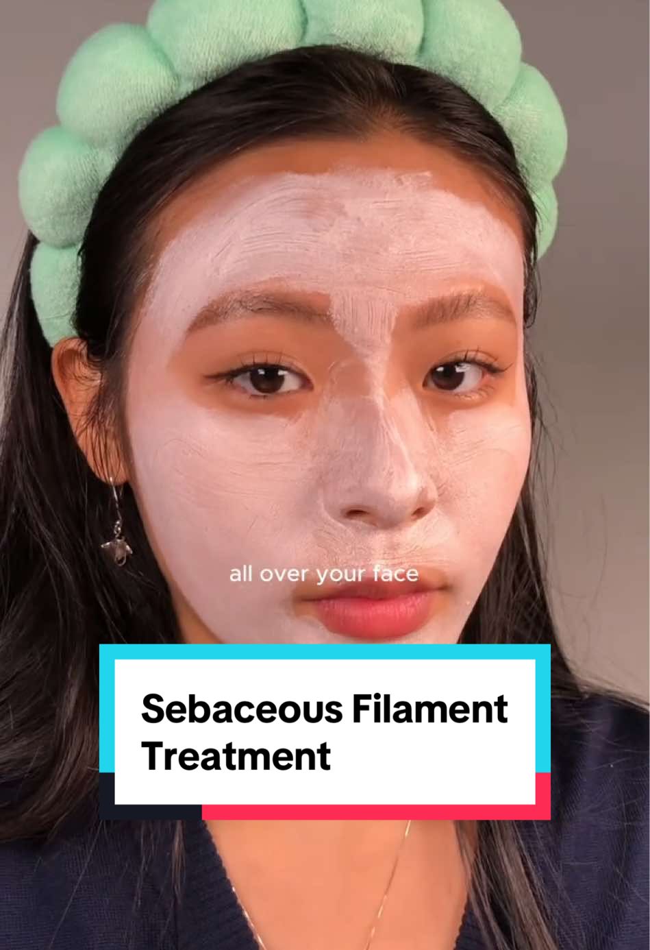 Note that sebaceous filaments are completely normal. There’s nothing wrong with it. But these are a few tips to help👩🏽‍💻 #creatorsearchinsights#sebaceousfilament#skintok#skincaretips#oilyskintips#oilyskin#pinkstick#poremizing#pores#mask#claymask#claystick#skin1004#koreanskincare#poreminimizer@SKIN1004 Official