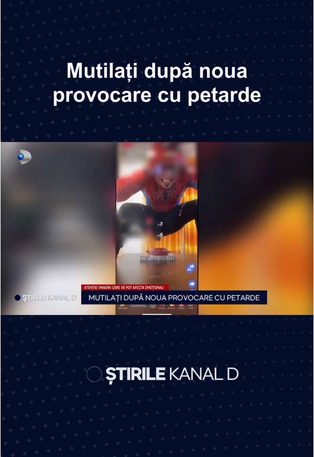 Peste 20 de copii au ajuns la spital răniți și chiar mutiliați după ce au făcut o nouă provocare periculoasă pe o rețea de socializare, de data aceasta cu petarde. 🔵Trei dintre răniți sunt din Slatina, iar unul se află chiar în stare gravă după ce a fost afectat de explozie. 🔵 Medicii fac eforturi mari să-i reconstuiască unui minor degetele de la mâini. #stirilekanald #kanaldromania #provocare #petarde #rani #urgente #cameradegarda #challenge