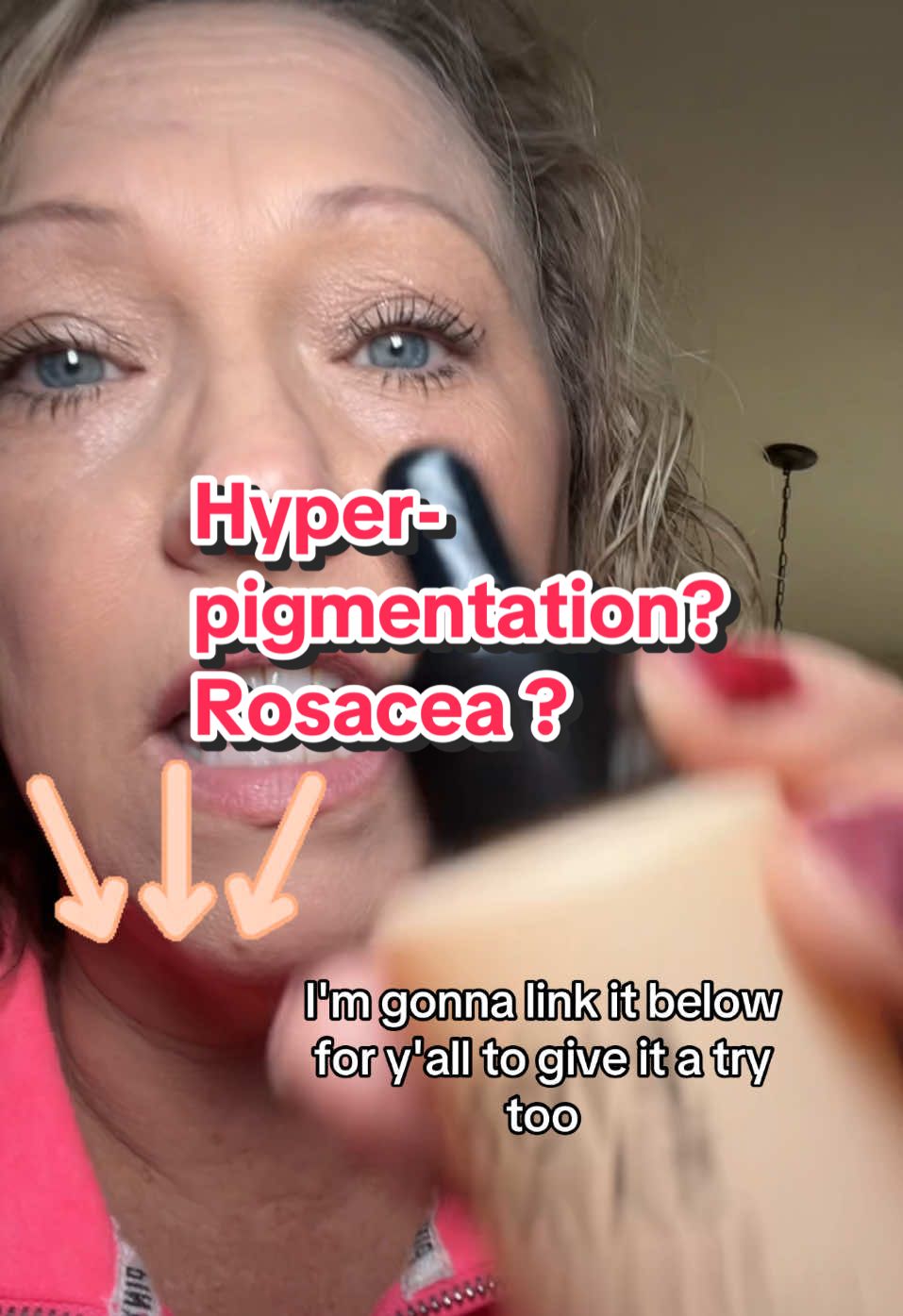 #hyperpigmentation #hyperpigmentationtreatment #rosacea#rosaceaskincare #rosaceaskincaretips  @Eight Saints Skincare #eightsaintsskincare #eightsaints