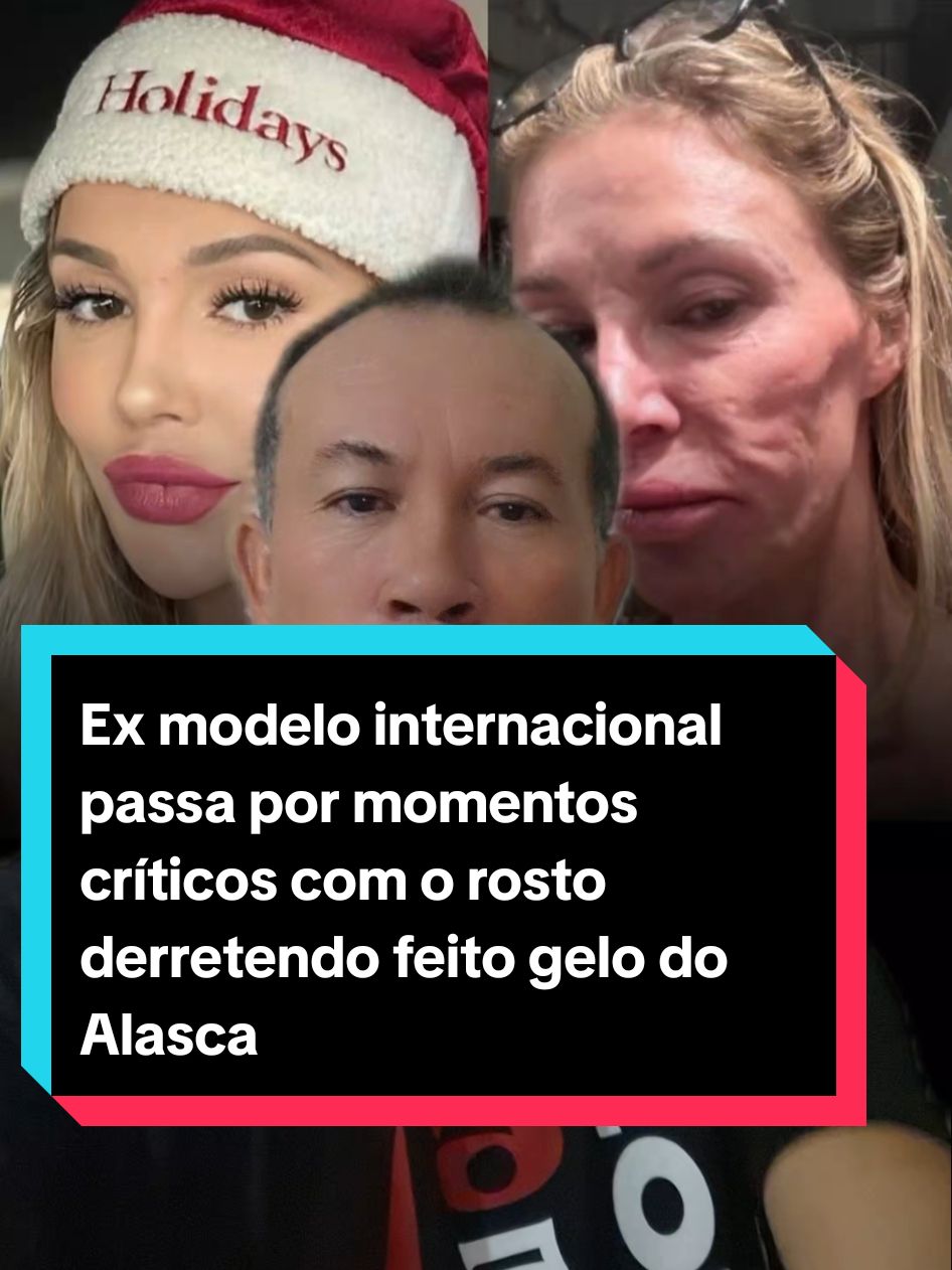 Os médicos não sabem mais o que fazer #Modelo #Estética #procedimentosesteticos #Plástica #Harmonização #Notícias #Entretenimento #fofoca #crescernotiktok #Internet #TikTok #Reality 