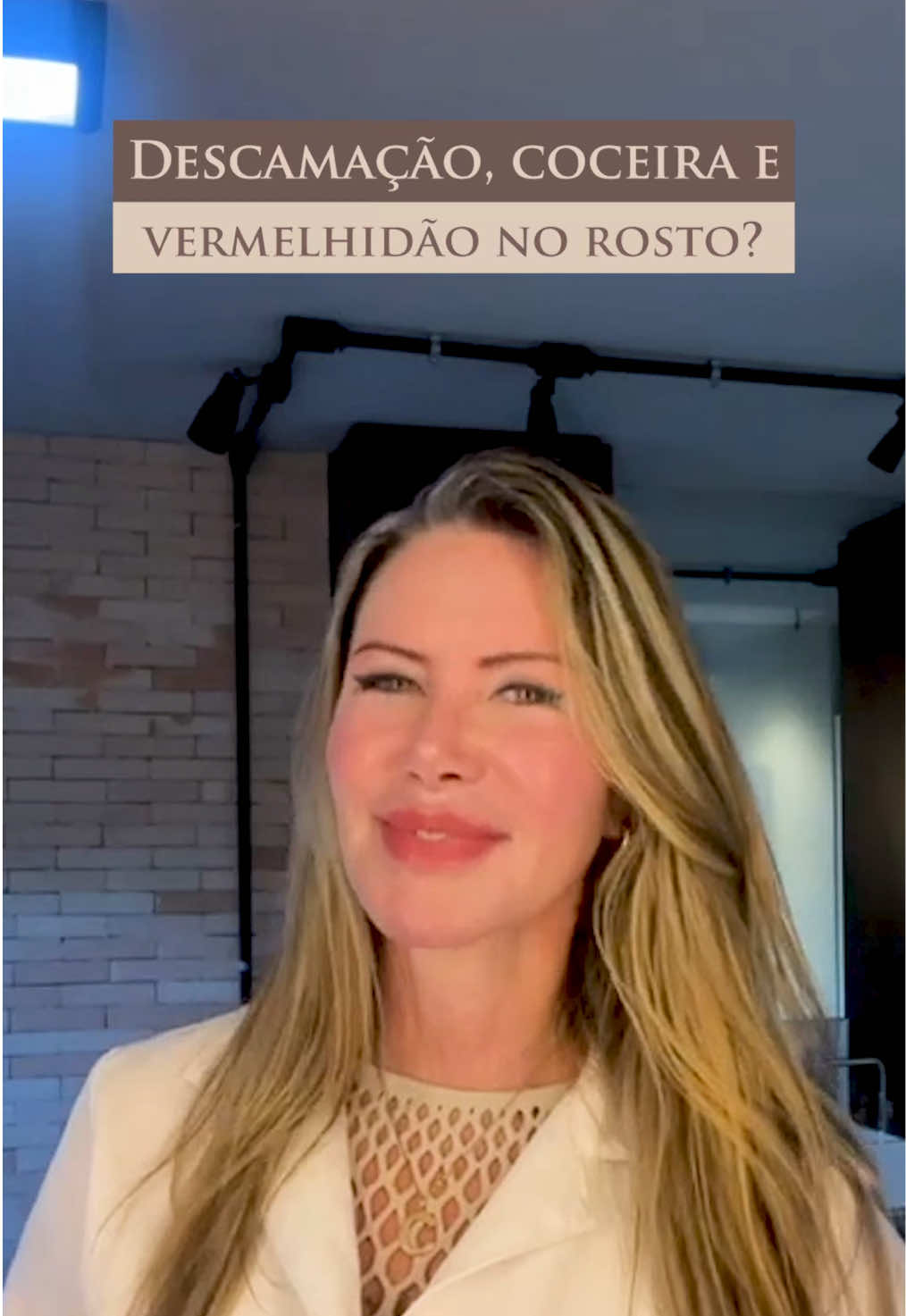 Você já notou essa descamação no rosto? ⚜️ Essa descamação pode ser dermatite seborreica, uma condição comum que pode surgir em outras áreas do corpo, como no tórax anterior. ⚜️ A produção excessiva de oleosidade, a presença do fungo Malassezia, fatores genéticos, alergias e até mesmo o estresse e a ansiedade estão entre os principais desencadeantes. ⚜️ O uso do sabonete de enxofre pode ajudar a controlar os sintomas, reduzindo a oleosidade e combatendo o fungo. Uma dieta equilibrada retirando açúcar e leite de origem animal também é recomendada. ⚜️ Se os sintomas persistirem, é importante consultar um dermatologista, pois medicamentos podem ser recomendados. E você, conhece alguém que tenha dermatite seborreica? #dermatiteseborreica #dermatite #caspa #anticaspa #dicas #tratamento #cuidadoscomapele #dermatologista #dermato