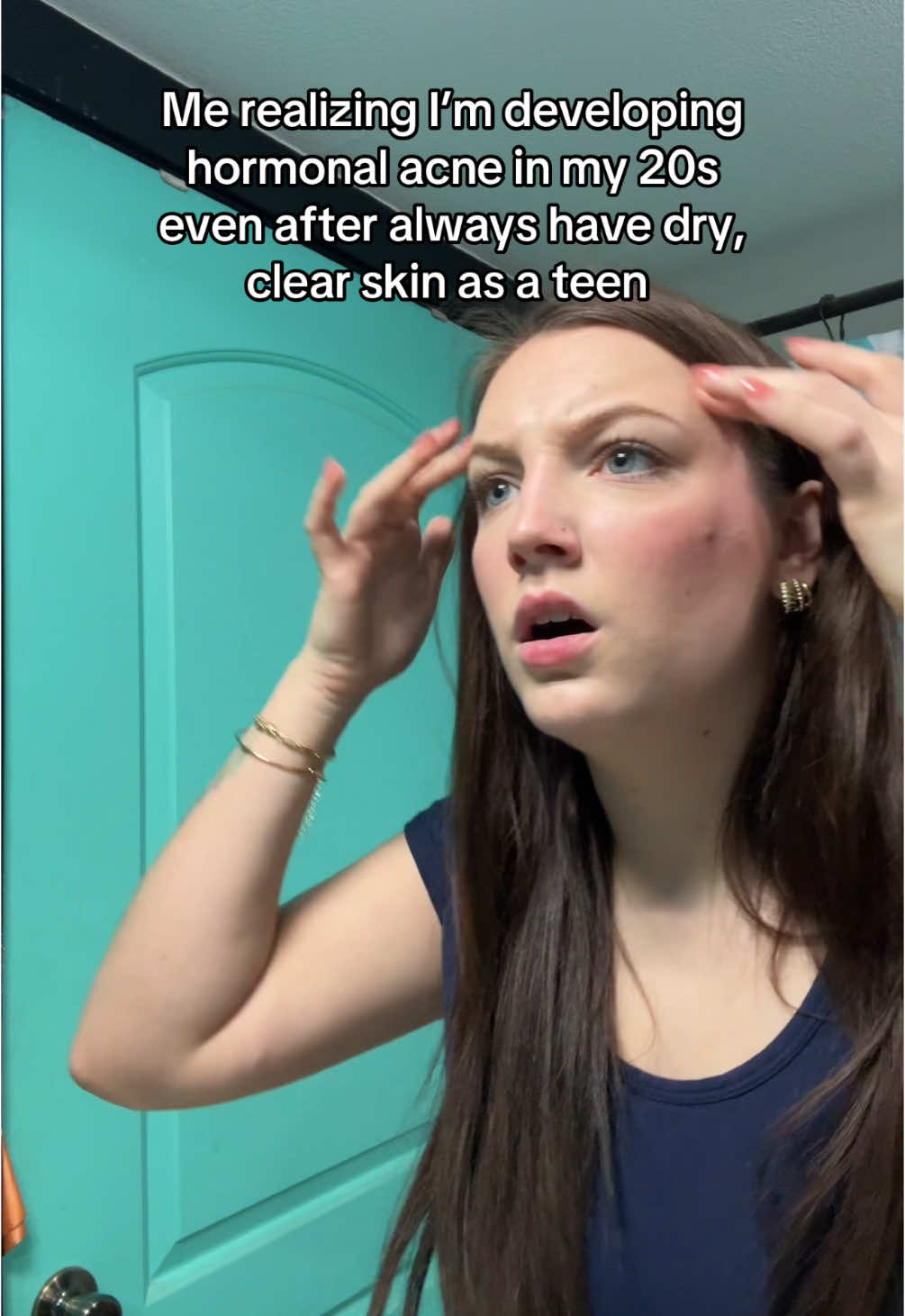 I really thought I was safe😭 #acne #hormonalacne #adultacne #skincareroutine #skintok 