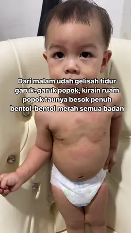 #throwback waktu dedek biduran.. Kasihan dedek pasti gatel banget bentol2 merah semua badan.. dr malemnya tidur udh ga tenang tp badan belum merah2 gini baru sorenya muncul banyak banget makin nyebar.. padahal kalo dari makannya ga ada makan yang aneh-aneh. Malemnya dikasih obat alhamdulillah pas tidur perlahan semua hilang, masih belum tau alergi krn apa, kyknya lebih ke alergi dingin krn cuaca memang lagi dingin banget, jadi skrg tiap lagi cuaca dingin hujan mulai antisipasi.. atau mungkinkah biduran krn alergi binatang2 kecilkah? Boleh sharing pengalaman Bunda👇🏻 #biduran #bidurananak #gatalgatal #alergi #alergianak #tipsanak #kulitgatal 