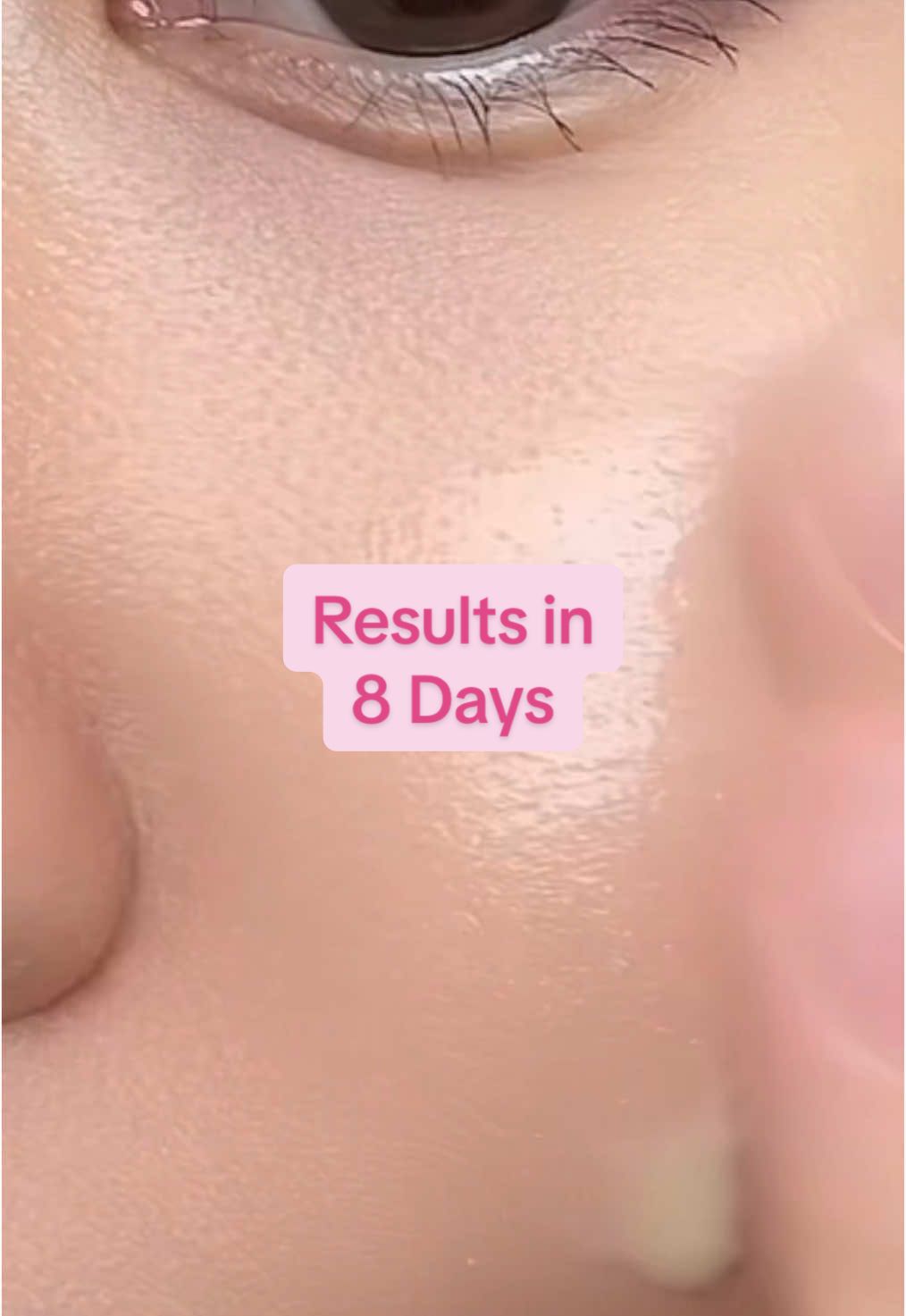 Invest just 8 days for bright & tight skin ✨ Product used: Varihope 8 day Vitamin Serum  #varihope #8daysvitamincserum #vitaminc #hyperpigmentation #kbeautyfinds #viralkoreanskincare #skincareproducts #vitamincserum 