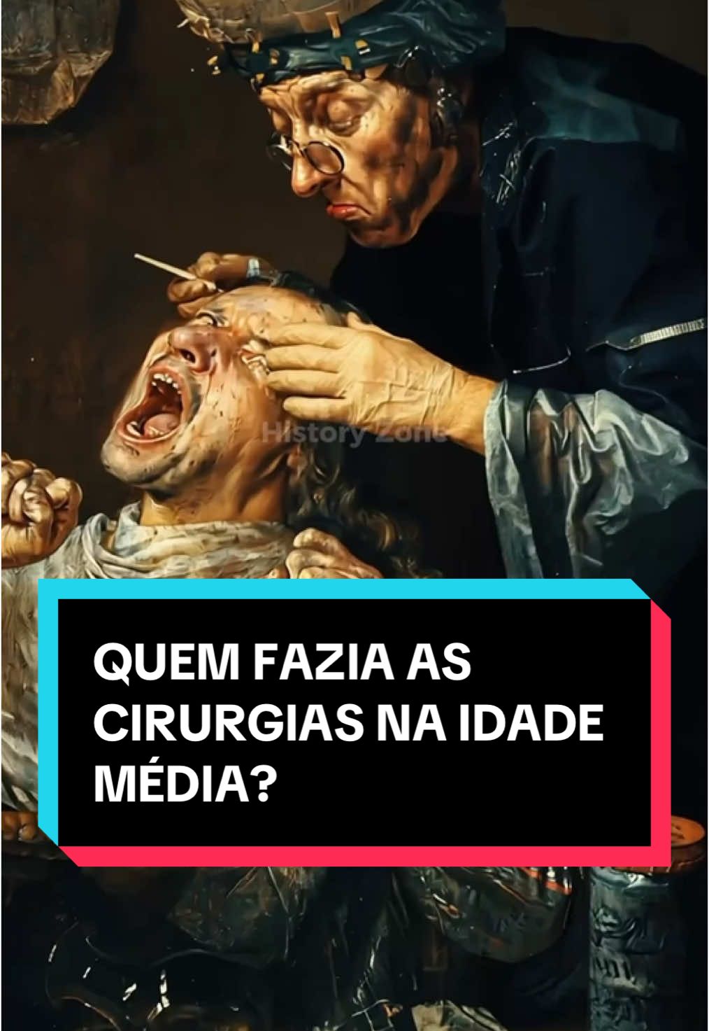 Quem fazia as cirurgias na idade média? #historia #curiosidades #idademedia #fatoscuriosos #fatosdesconhecidos 