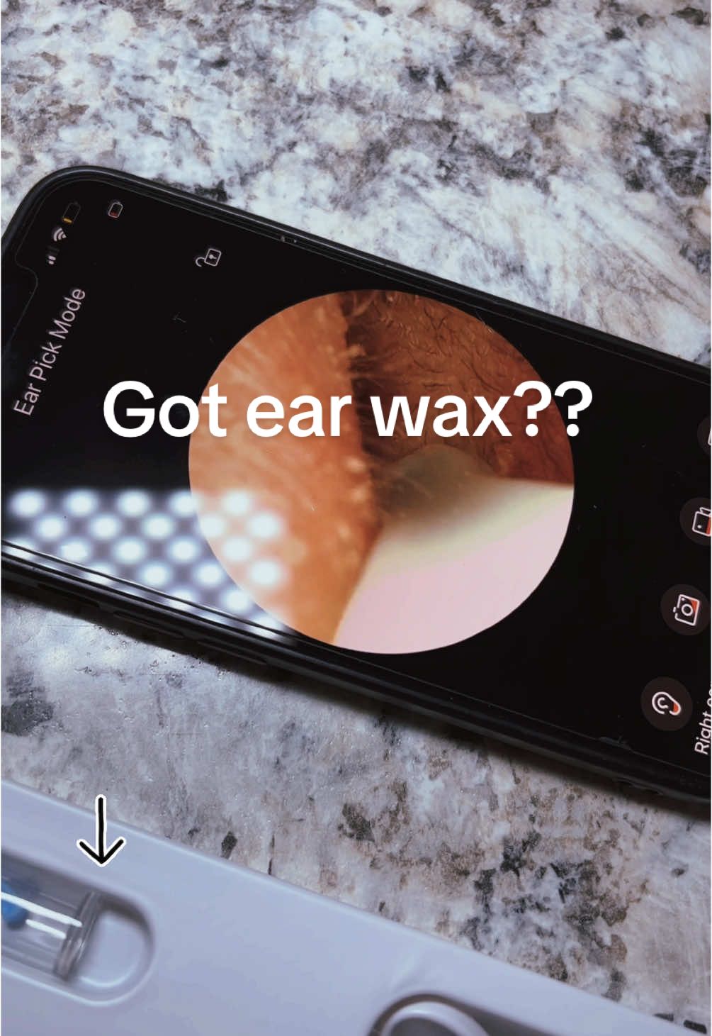 This is so neat! I’m so shocked at how inexpensive it is! You can look in your ear, nose and mouth! Every household should have one of these! #earwaxremover #earwaxremoval #earwaxcameras #earwax #tiktokshopholidayhaul 