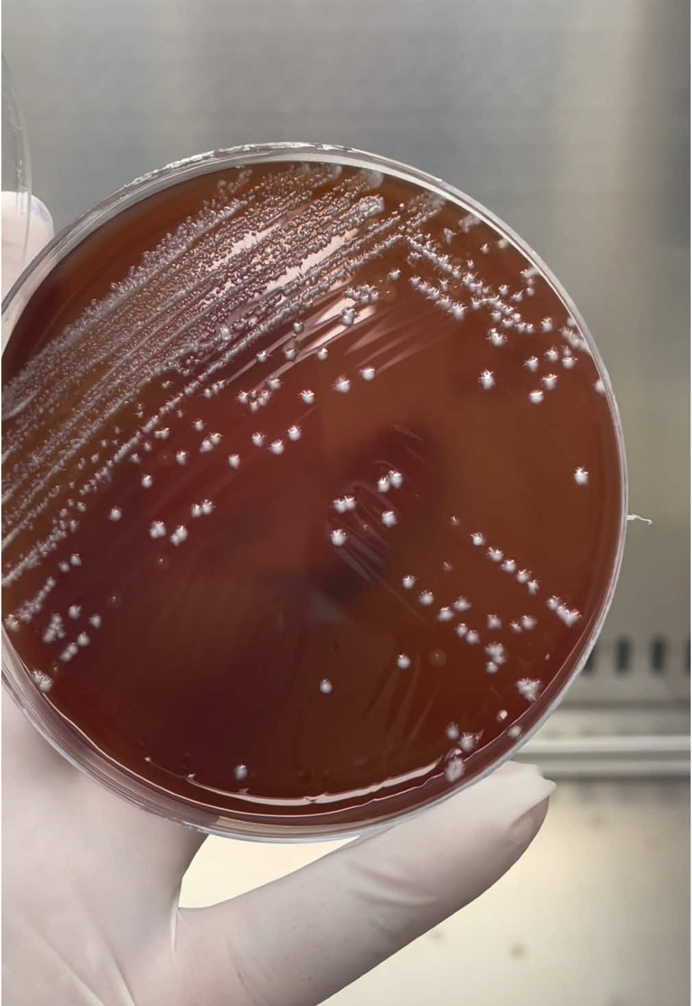 Bạn có thể đoán tên vi sinh vật này trong 5 giây không? Thử ngay! #visinh #lablife #xetnghiem #microbiology #sinhvienyduoc #yeastinfection #labinsight #kythuatvienxetnghiem💉🌡  @Lab insight 