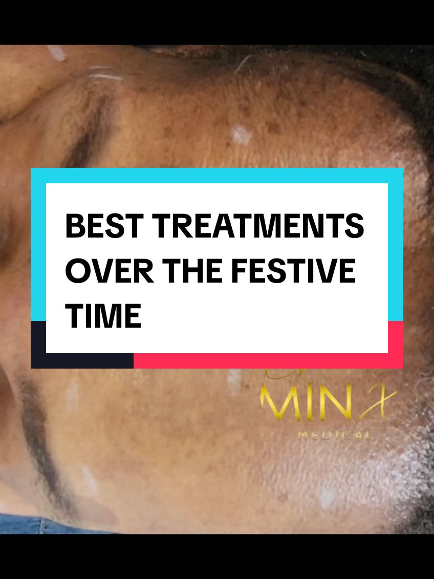 WHAT is the NO 1 pre holiday treatment ???? ❤️ wrinkle reduction ❤️💯 WHY? Look younger in 5-7 days No downtime Quick results  Whatsapp 072 350 6013 for a booking  #SAMA28 #skindoctor #skin #evenskin #antiaging #drminx #skinhealth #collagenstimulation 