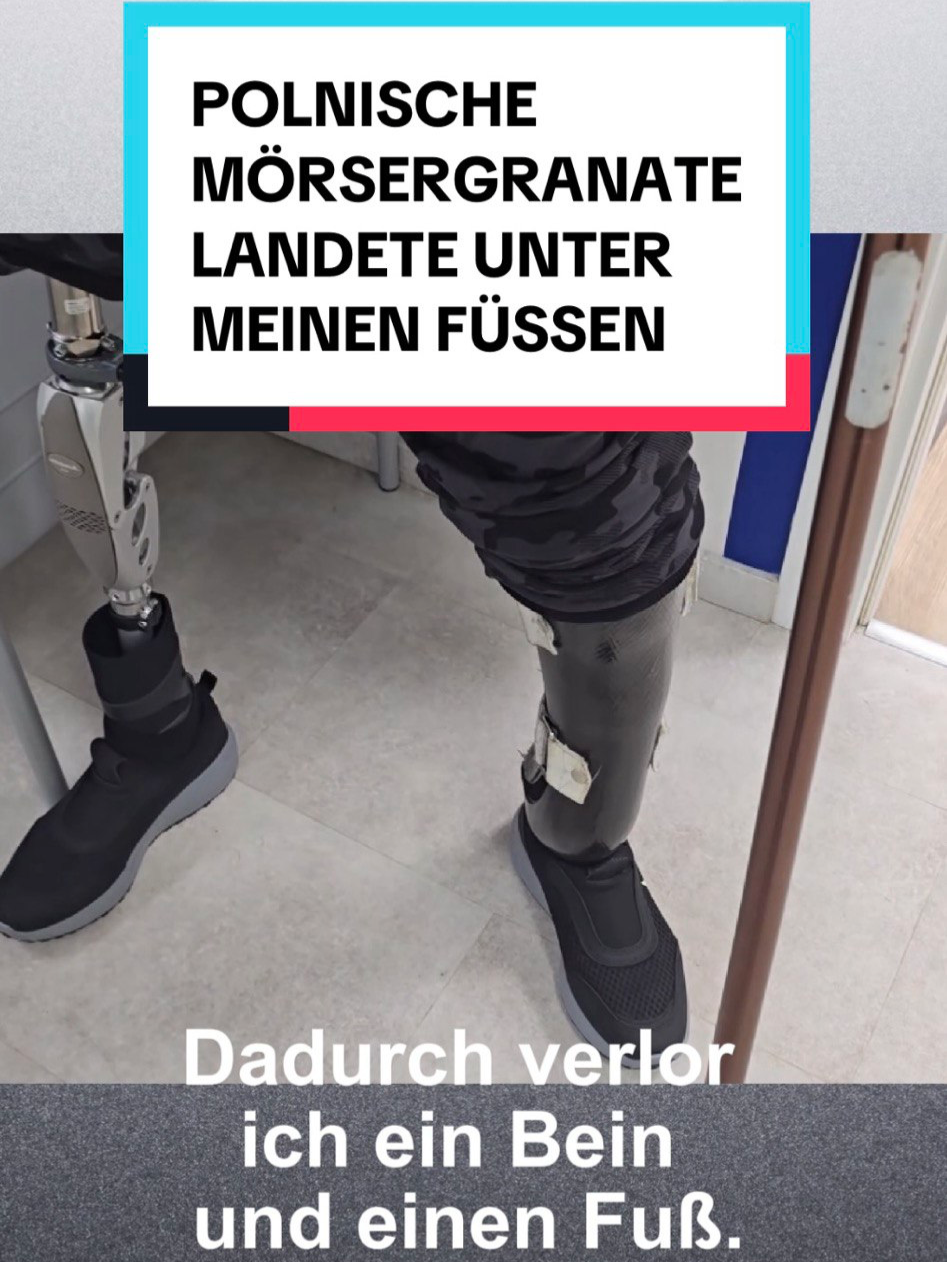 Die Geschichte eines Soldaten, der an der Front schwer verwundet wurde und ein Bein verlor. Die Hoffnung auf ein weiteres Leben gab er aber nicht auf. #russland #reabilitation #reabilitation #prothese #hoffnung