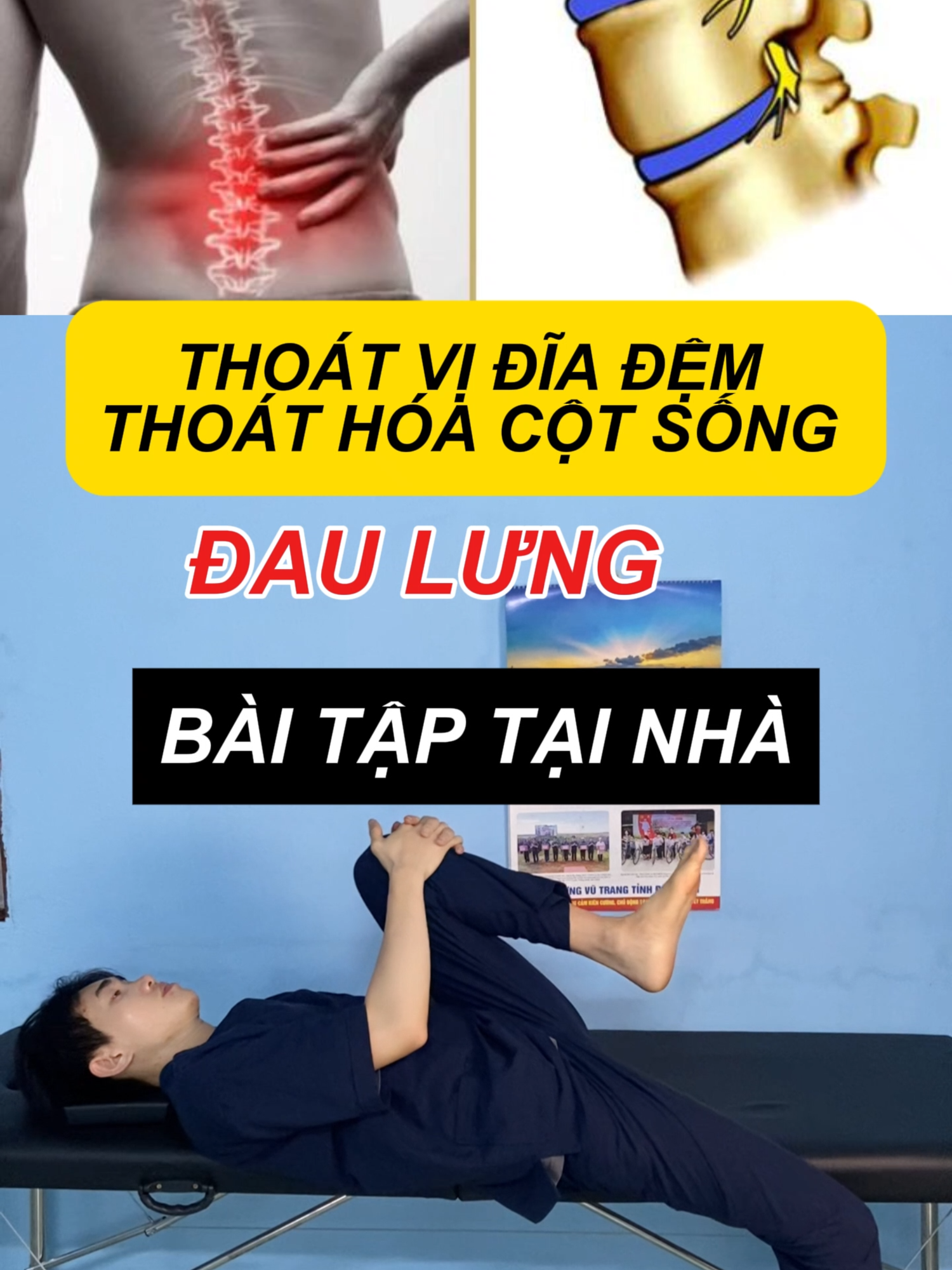 Bài tập thoát vị đĩa đệm tại nhà phần 8 #thoatvidiadem #thoaihoacotsong #dauthankinhtoa #coxuongkhop #chanthuong  #daucotsong #songkhoe247 #baitapthoaividiademtainha #thongtrilieuvien