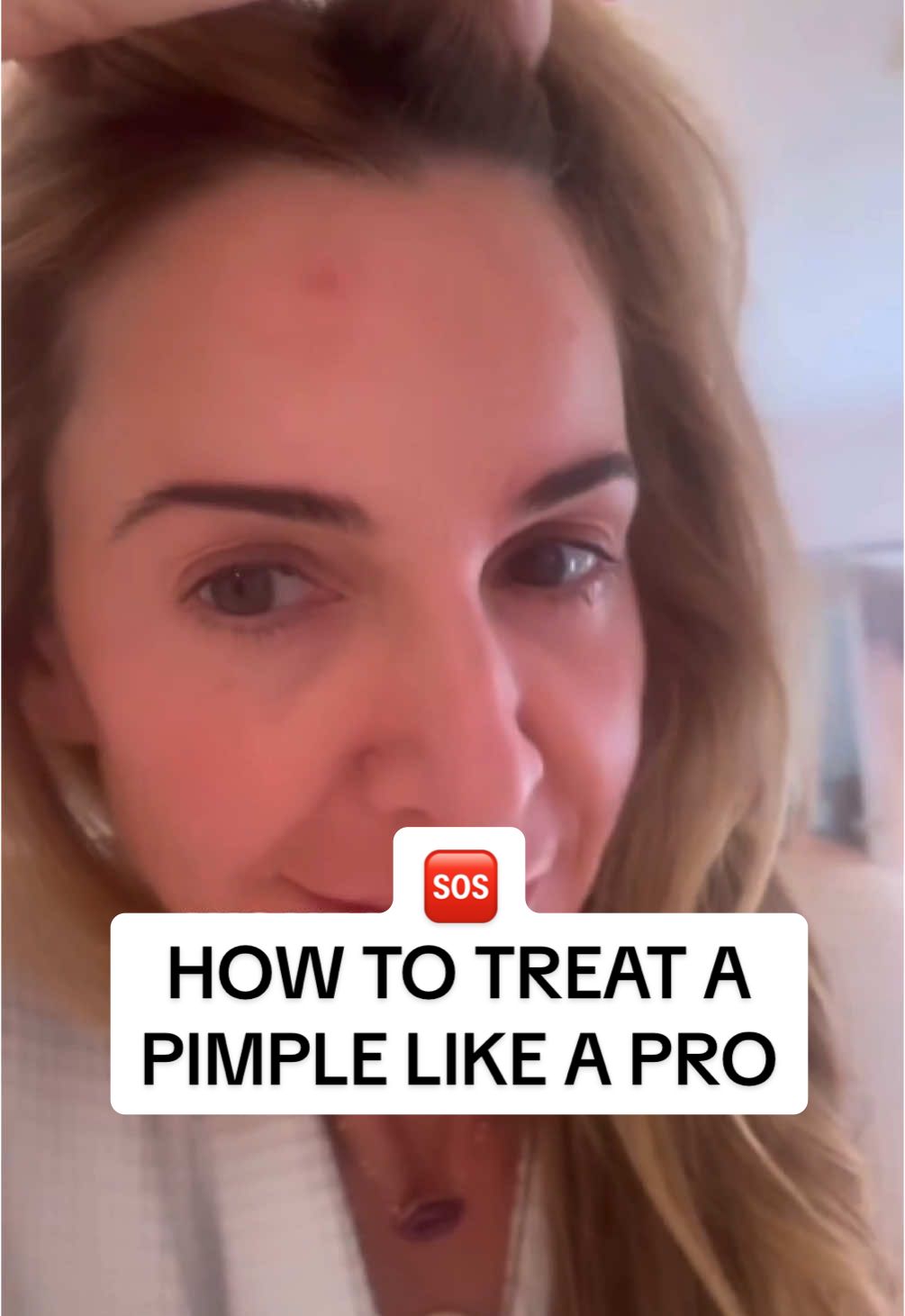 Yes — even Rhea gets a pimple once in a while! 🆘 Here’s what she does to treat it: 🚫 NO picking — even pros like Rhea refrain from popping their own pimples! 👍 Grab your BPO — that’s code for Benzoyl Peroxide. Rhea is never without our La Suite Benzoyl Peroxide Acne Spot Treatment because when you need it, you need it! 💡Pro tip: apply a small dot of BPO *only* onto the pimple, so you don’t disrupt the unaffected area around it. It’s called “spot treatment” for a reason! #acnetreatment #acnetips #pimplesolution #skincaretips #SkinCare101 #benzoylperoxide